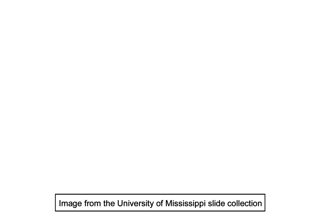 Image source >  <p>This image was taken of a slide in the University of Mississippi collection.</p>
