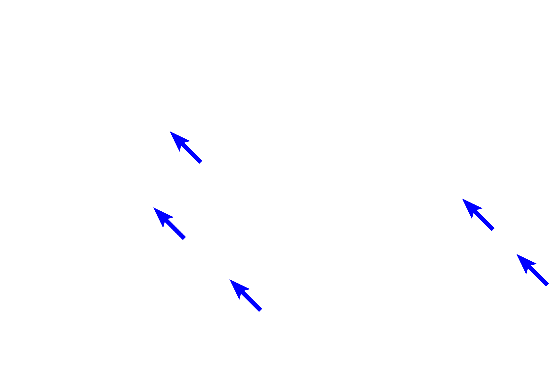  - Alveolar (pulmonary) capillaries <p>Pulmonary arteries supply deoxygenated blood to alveolar capillaries in the interalveolar septa. The walls of these capillaries form a portion of the air-blood barrier, across which oxygen and carbon dioxide are exchanged. Oxygenated blood from alveolar capillaries drains mostly into pulmonary veins. The presence of smooth muscle knobs indicates that this alveolus is attached to an alveolar duct. 1000x</p>
