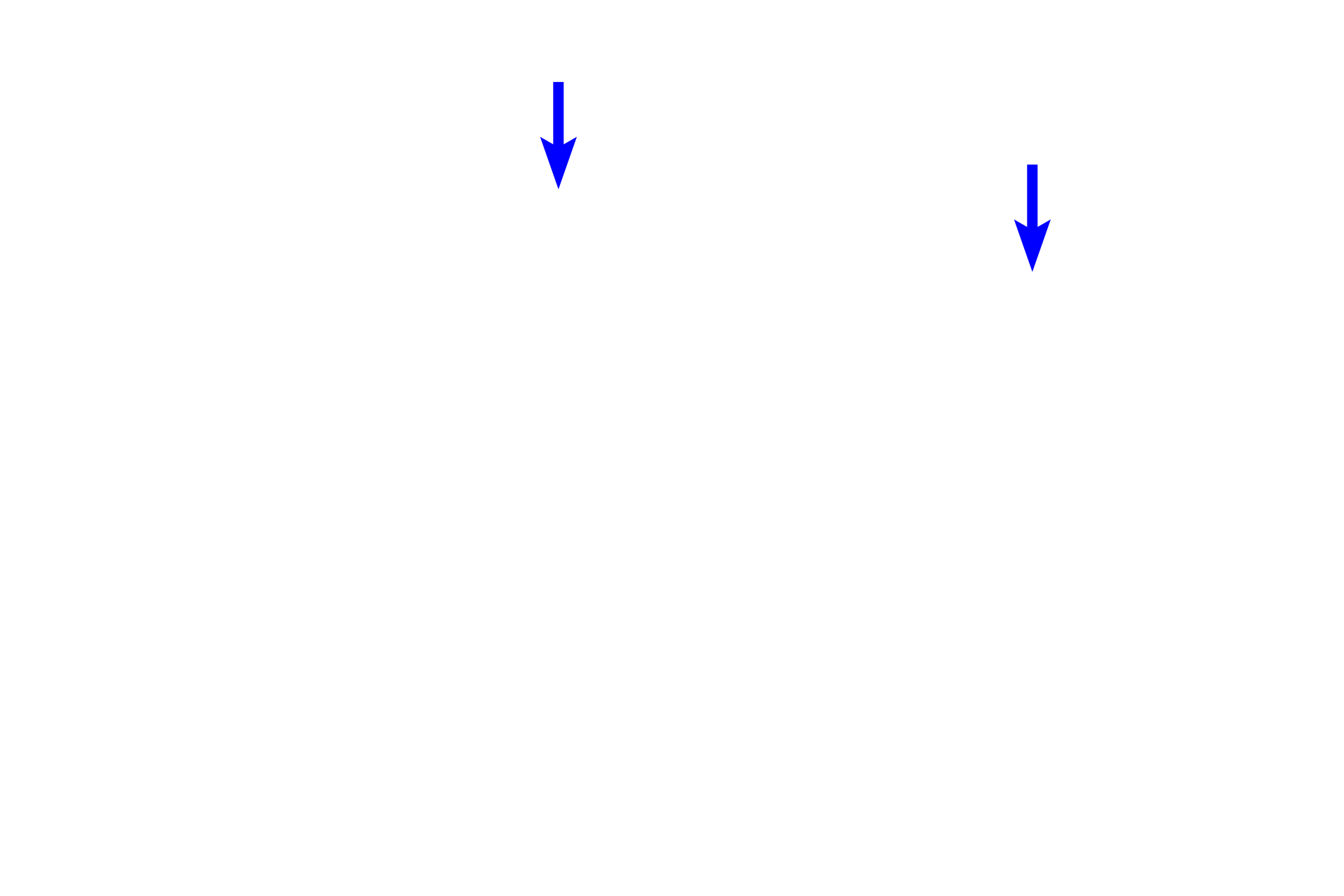  - Smooth muscle knobs <p>Pulmonary arteries supply deoxygenated blood to alveolar capillaries in the interalveolar septa. The walls of these capillaries form a portion of the air-blood barrier, across which oxygen and carbon dioxide are exchanged. Oxygenated blood from alveolar capillaries drains mostly into pulmonary veins. The presence of smooth muscle knobs indicates that this alveolus is attached to an alveolar duct. 1000x</p>
