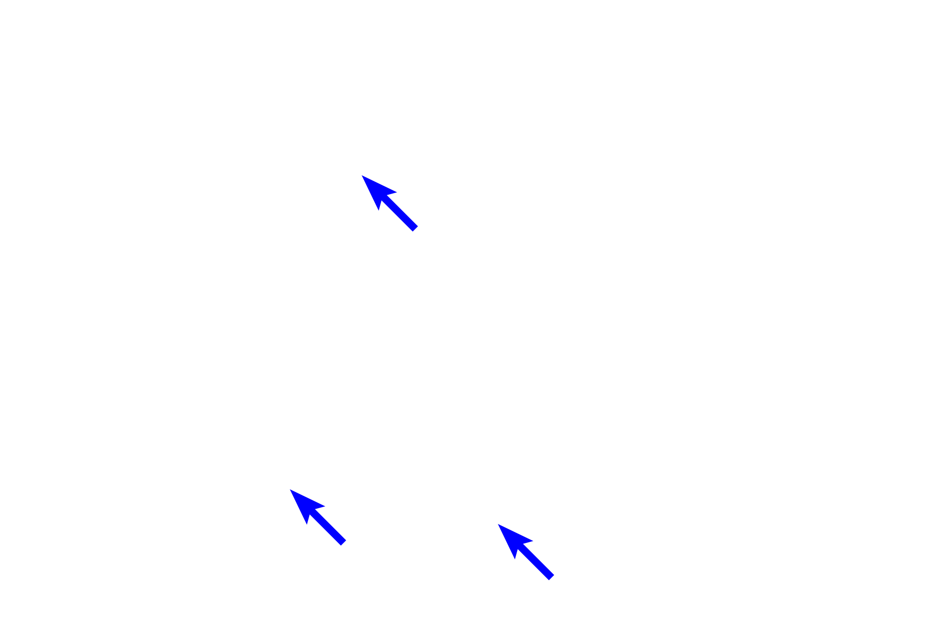  - Type II (septal) cells <p>Pulmonary arteries supply deoxygenated blood to alveolar capillaries in the interalveolar septa. The walls of these capillaries form a portion of the air-blood barrier, across which oxygen and carbon dioxide are exchanged. Oxygenated blood from alveolar capillaries drains mostly into pulmonary veins. The presence of smooth muscle knobs indicates that this alveolus is attached to an alveolar duct. 1000x</p>
