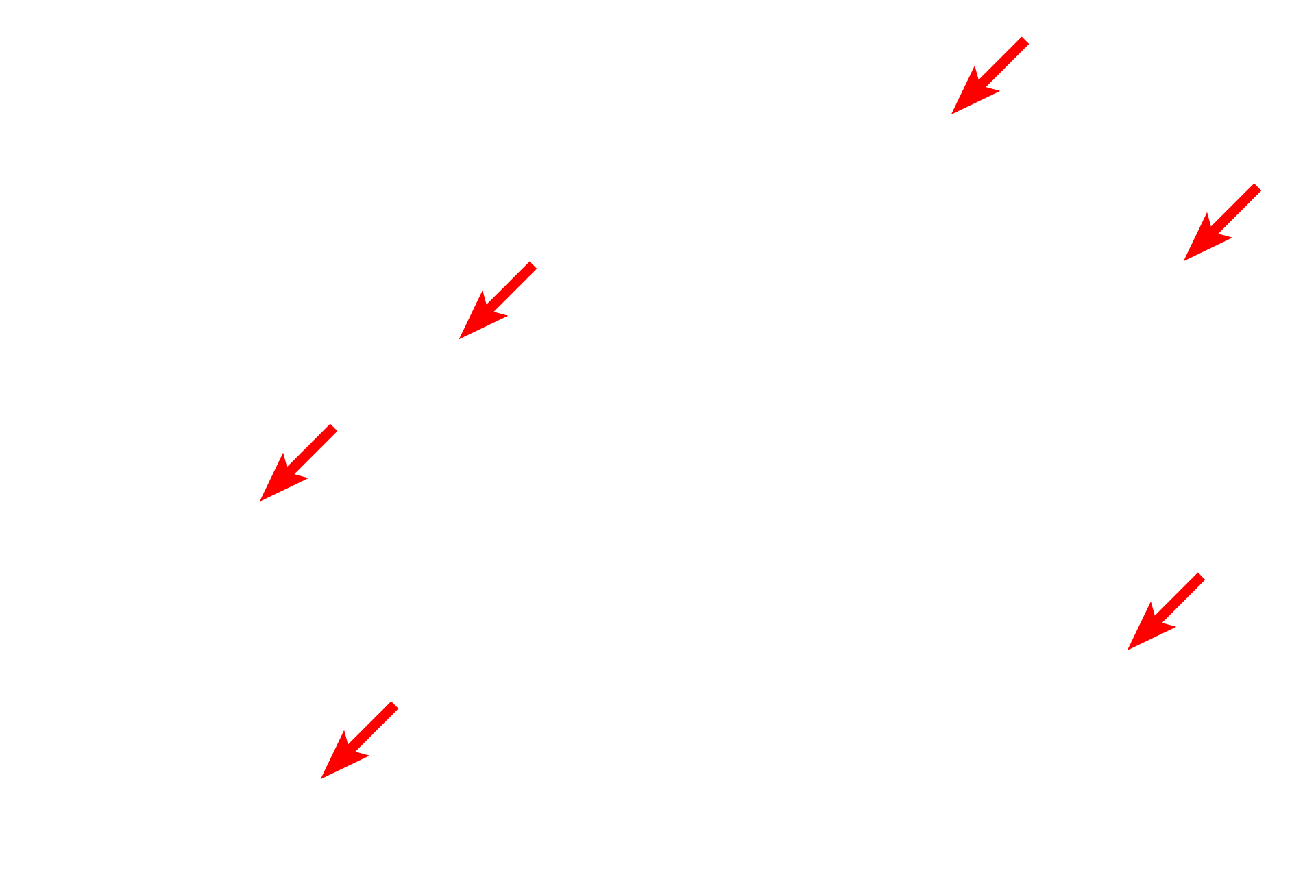 Alveolar (pulmonary) capillaries <p>The interalveolar septum is seen by light microscopy (left) and electron microscopy (right). Alveolar capillaries, supplied by the pulmonary artery, protrude from the interalveolar septum into the lumen of the alveolus, thus maximizing the surface area across which gas exchange can occur.  1500x, 4000x</p>
