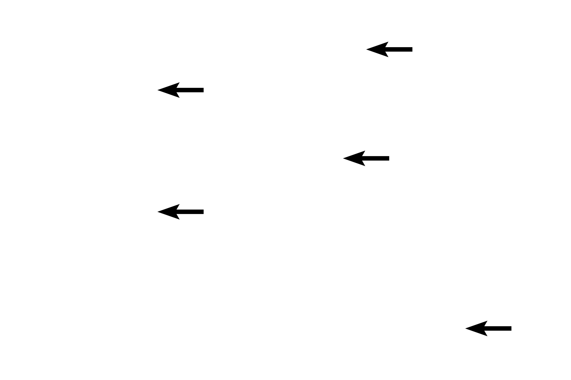Pulmonary veins <p>Oxygenated blood from alveolar capillaries flows into small pulmonary venules that gradually anastomose into larger veins. These vessels do not accompany respiratory passageways; instead, they travel alone, frequently seen in the connective tissue that supports the lung.  200x</p>

