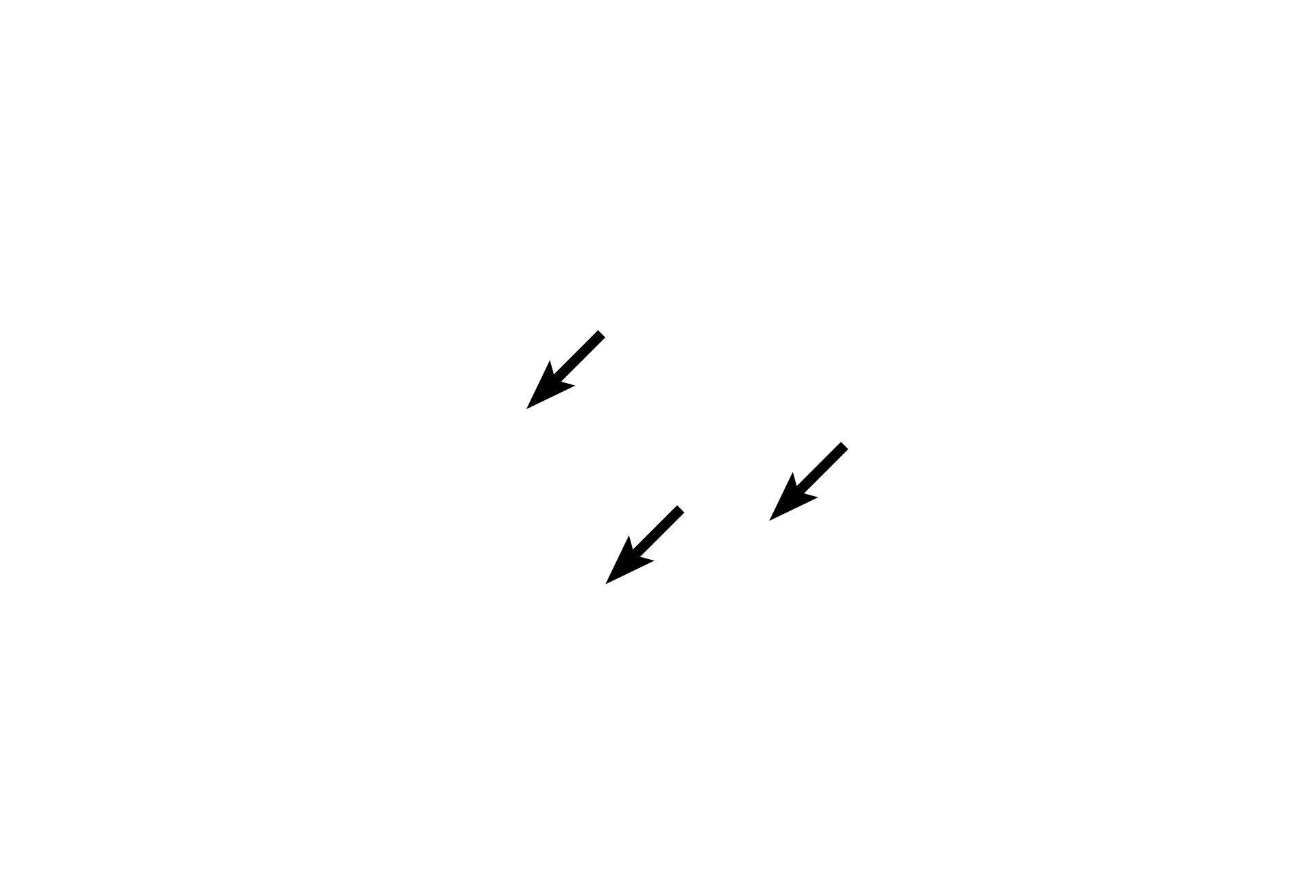 Alveolar ducts <p>Oxygenated blood from alveolar capillaries flows into small pulmonary venules that gradually anastomose into larger veins. These vessels do not accompany respiratory passageways; instead, they travel alone, frequently seen in the connective tissue that supports the lung.  200x</p>
