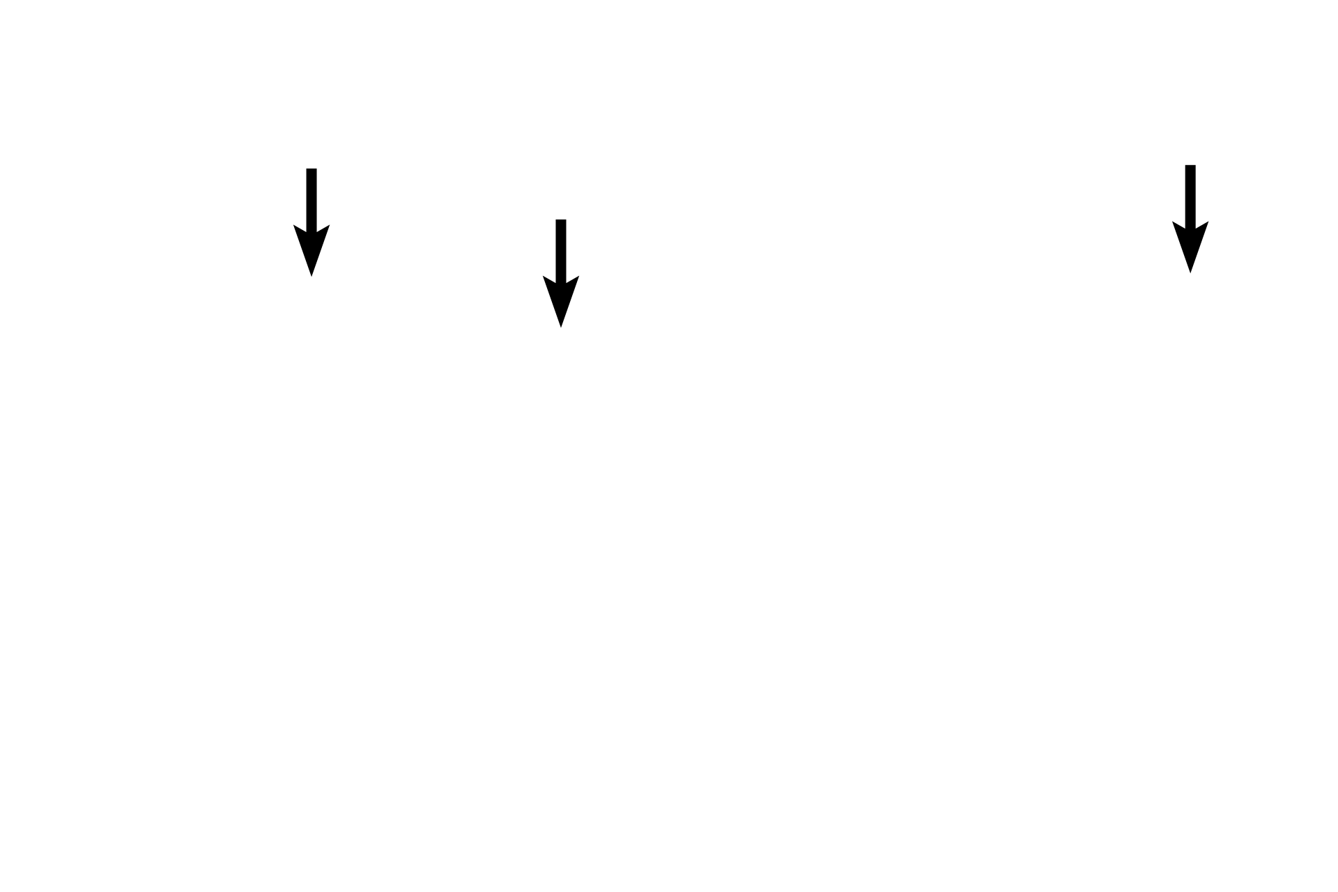 Pulmonary veins <p>A pulmonary vein located near the surface of the lung travels in thin connective tissue septa and is not associated with a respiratory passageway. Oxygenated blood in these vessels drains mostly into pulmonary veins.  200x</p>

