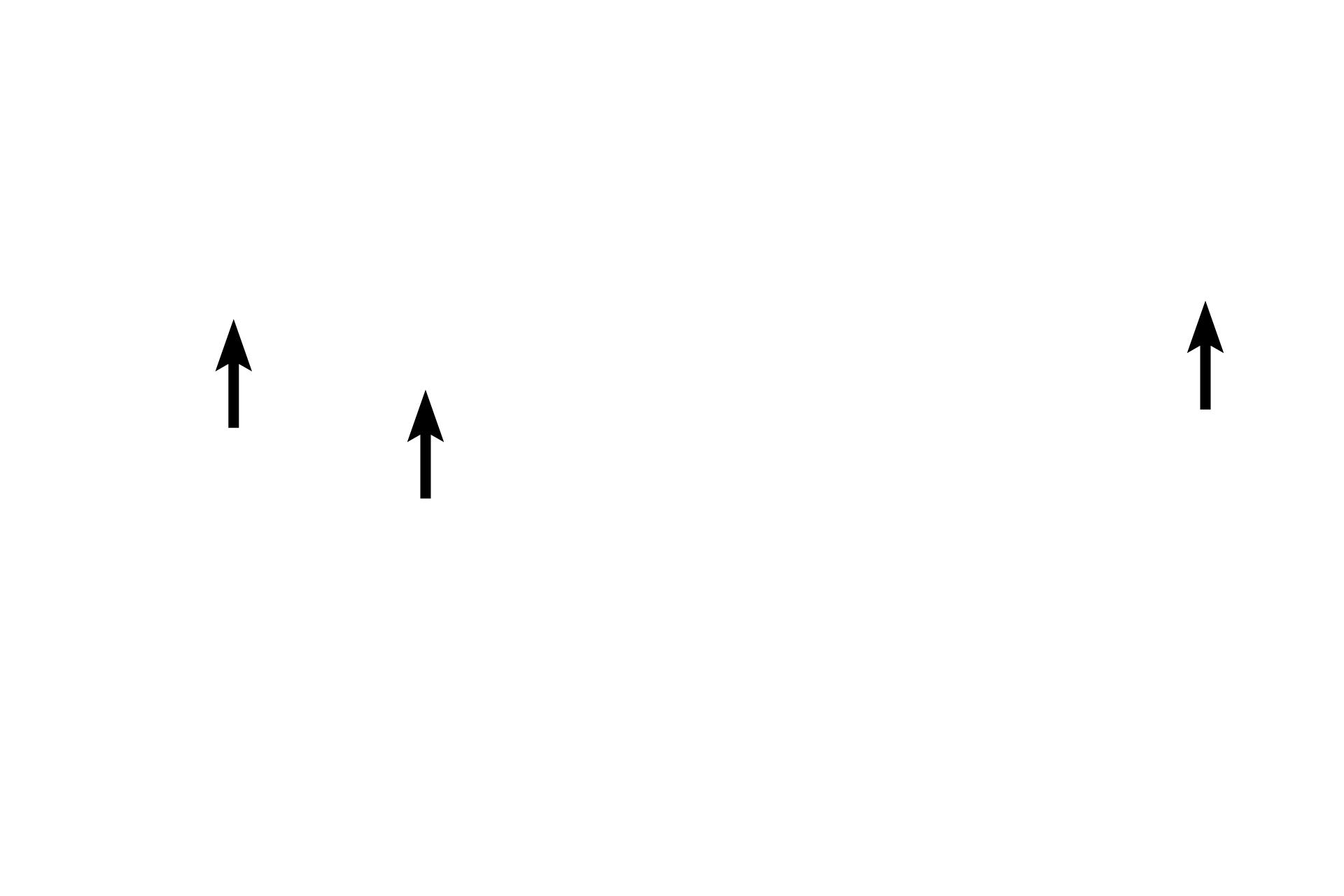 Connective tissue <p>A pulmonary vein located near the surface of the lung travels in thin connective tissue septa and is not associated with a respiratory passageway. Oxygenated blood in these vessels drains mostly into pulmonary veins.  200x</p>
