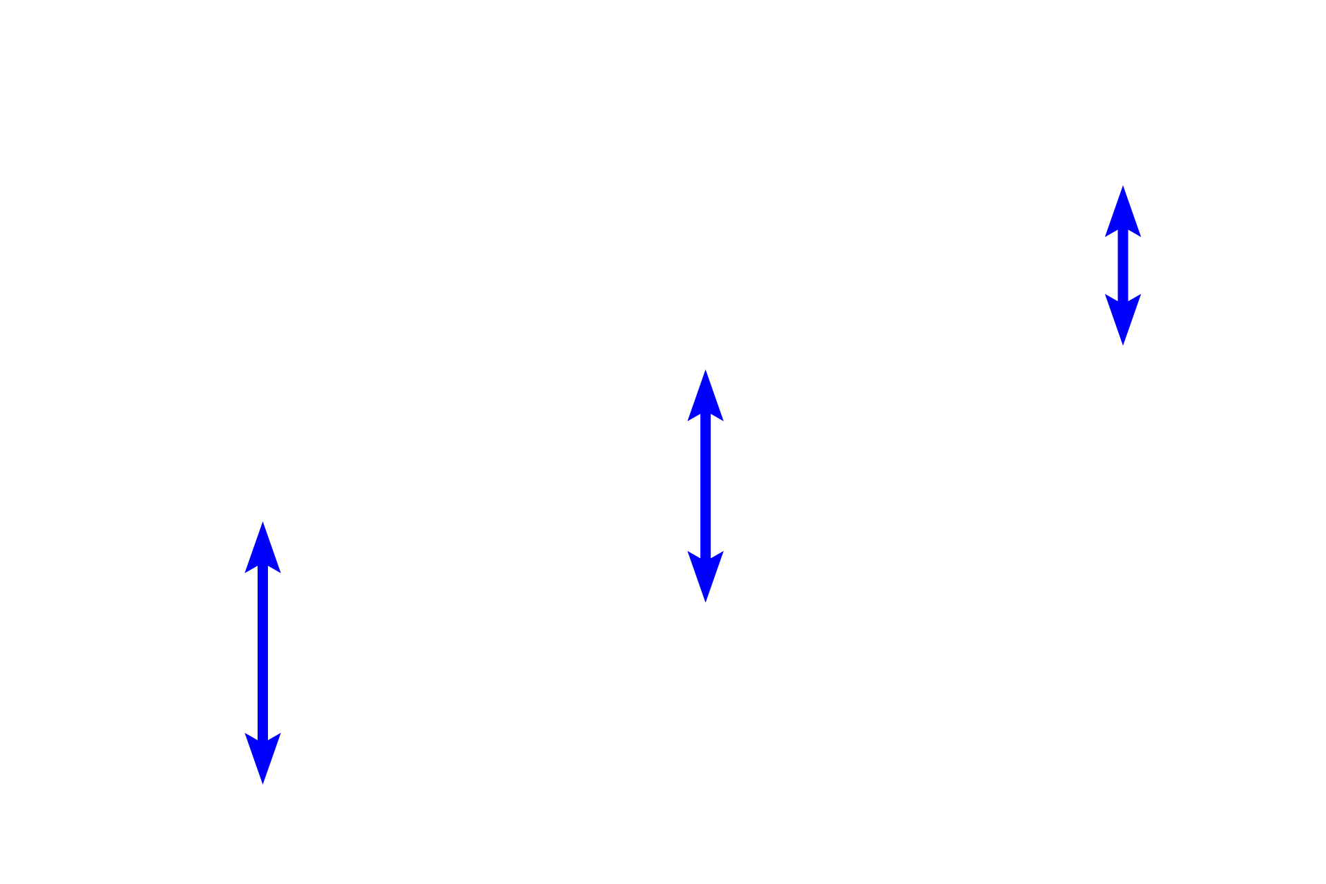 Pulmonary vein <p>This longitudinal section of a large pulmonary vein will join others to form two main pulmonary veins that exit the lung at the hilum, accompanied by a primary bronchus and a pulmonary artery. Blood in pulmonary veins returns to the left atrium of the heart, joining the general systemic circulation. A portion of the pleura has detached from the surface of the lung.  40x</p>
