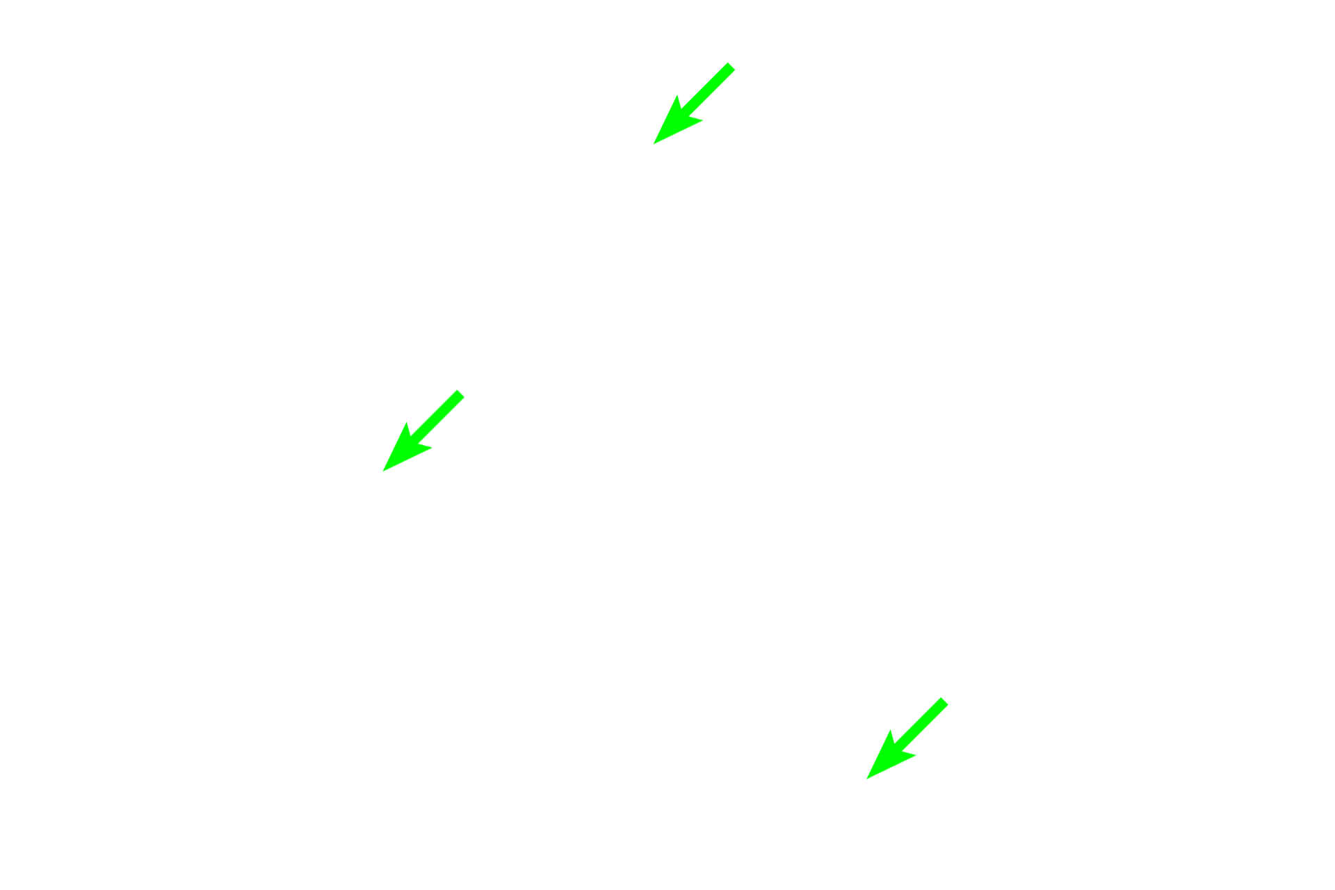 Epithelium <p>Larger bronchioles, seen here, are lined by a ciliated, pseudostratified columnar epithelium that gradually changes to ciliated, simple cuboidal with decreasing numbers of goblet cells. A relatively thick layer of circular smooth muscle is present. Bronchioles lack both cartilage plates and glands.  200x</p>
