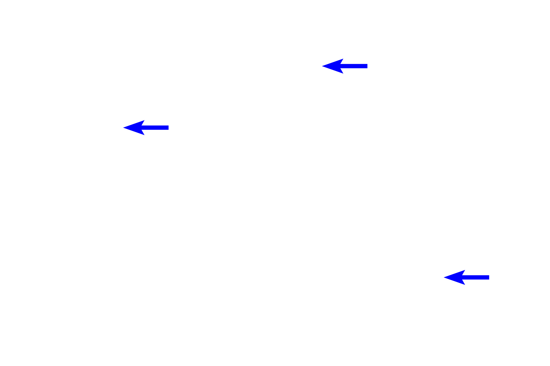  - Cilia <p>Larger bronchioles, seen here, are lined by a ciliated, pseudostratified columnar epithelium that gradually changes to ciliated, simple cuboidal with decreasing numbers of goblet cells. A relatively thick layer of circular smooth muscle is present. Bronchioles lack both cartilage plates and glands.  200x</p>
