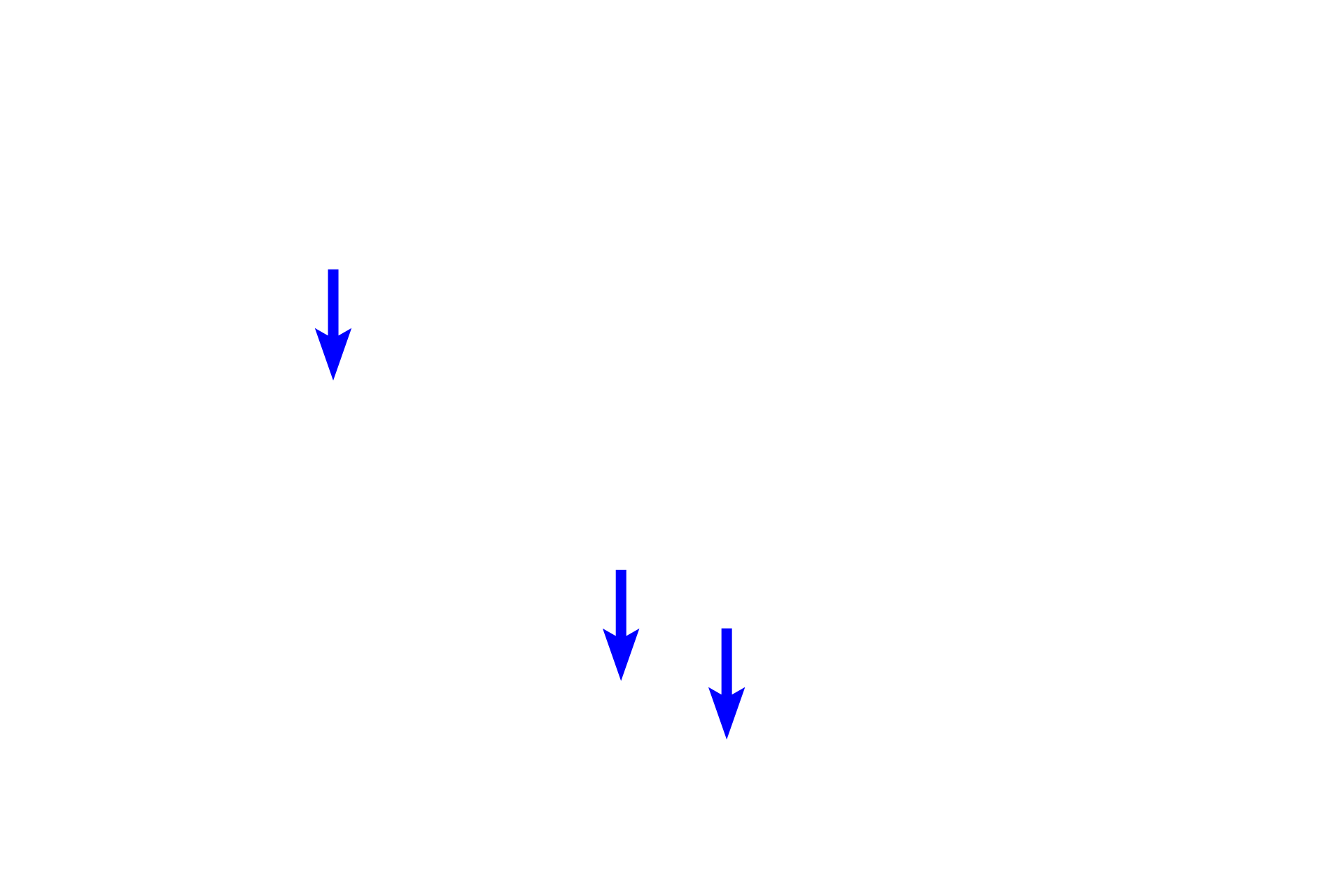  - Goblet cells <p>Larger bronchioles, seen here, are lined by a ciliated, pseudostratified columnar epithelium that gradually changes to ciliated, simple cuboidal with decreasing numbers of goblet cells. A relatively thick layer of circular smooth muscle is present. Bronchioles lack both cartilage plates and glands.  200x</p>
