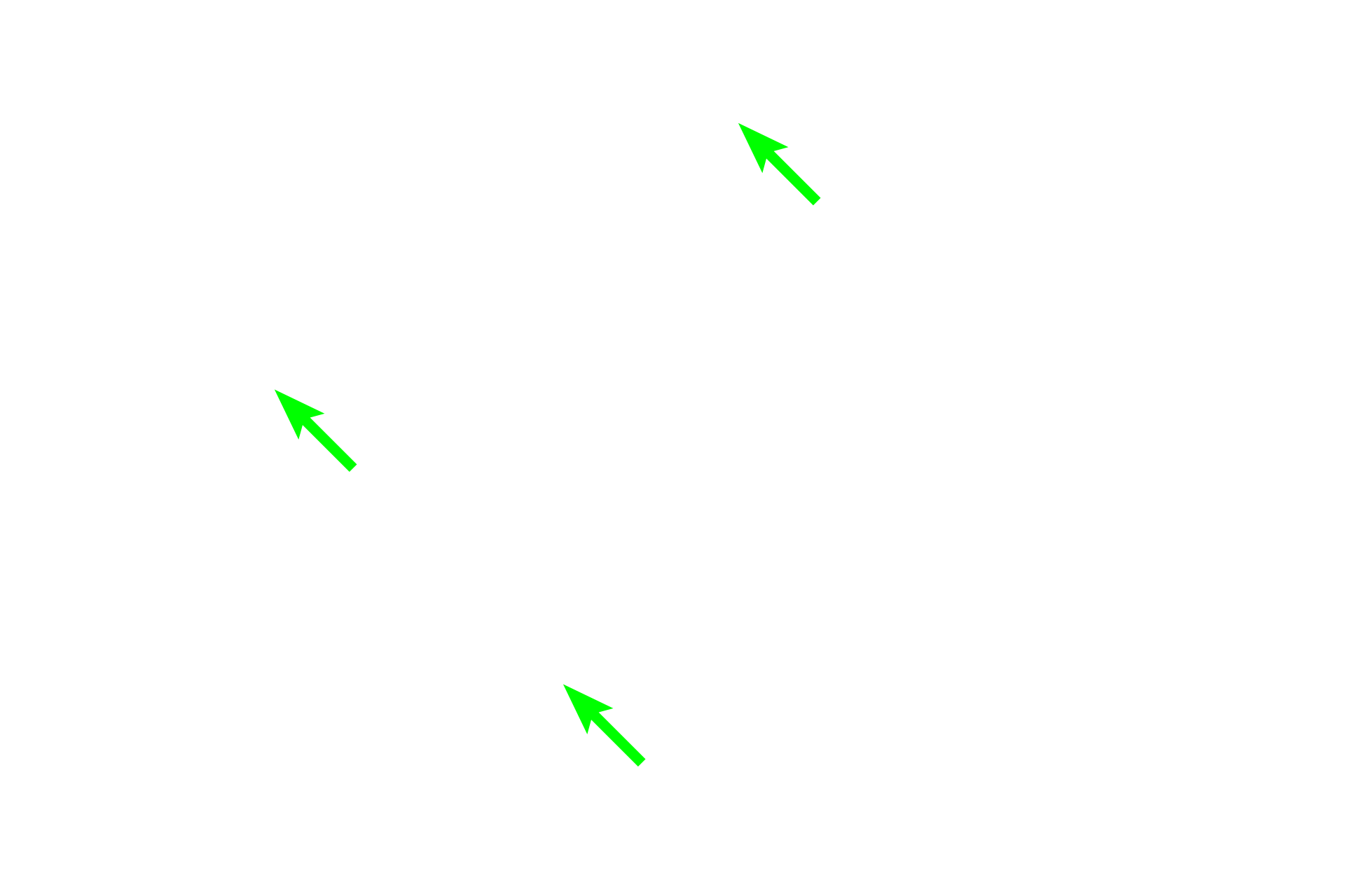 Lamina propria <p>Larger bronchioles, seen here, are lined by a ciliated, pseudostratified columnar epithelium that gradually changes to ciliated, simple cuboidal with decreasing numbers of goblet cells. A relatively thick layer of circular smooth muscle is present. Bronchioles lack both cartilage plates and glands.  200x</p>
