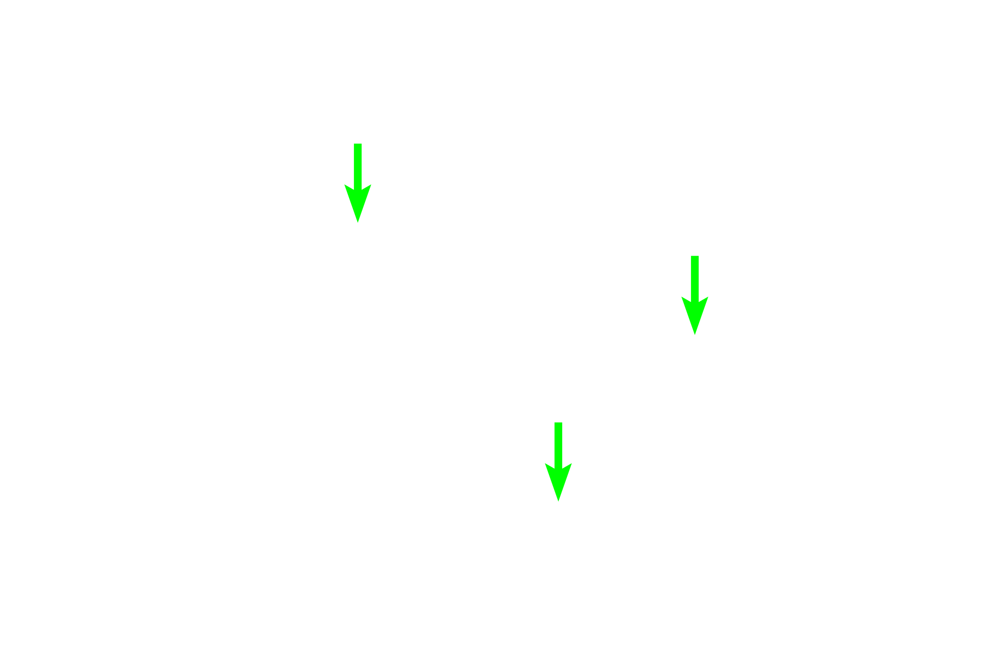 Epithelium <p>Bronchioles often appear constricted due to postmortem contraction of the prominent smooth muscle layer. Similar to the previous image, this bronchiole is lined by a ciliated, pseudostratified columnar epithelium. Note the absence of both cartilage plates and glands.  200x  </p>
