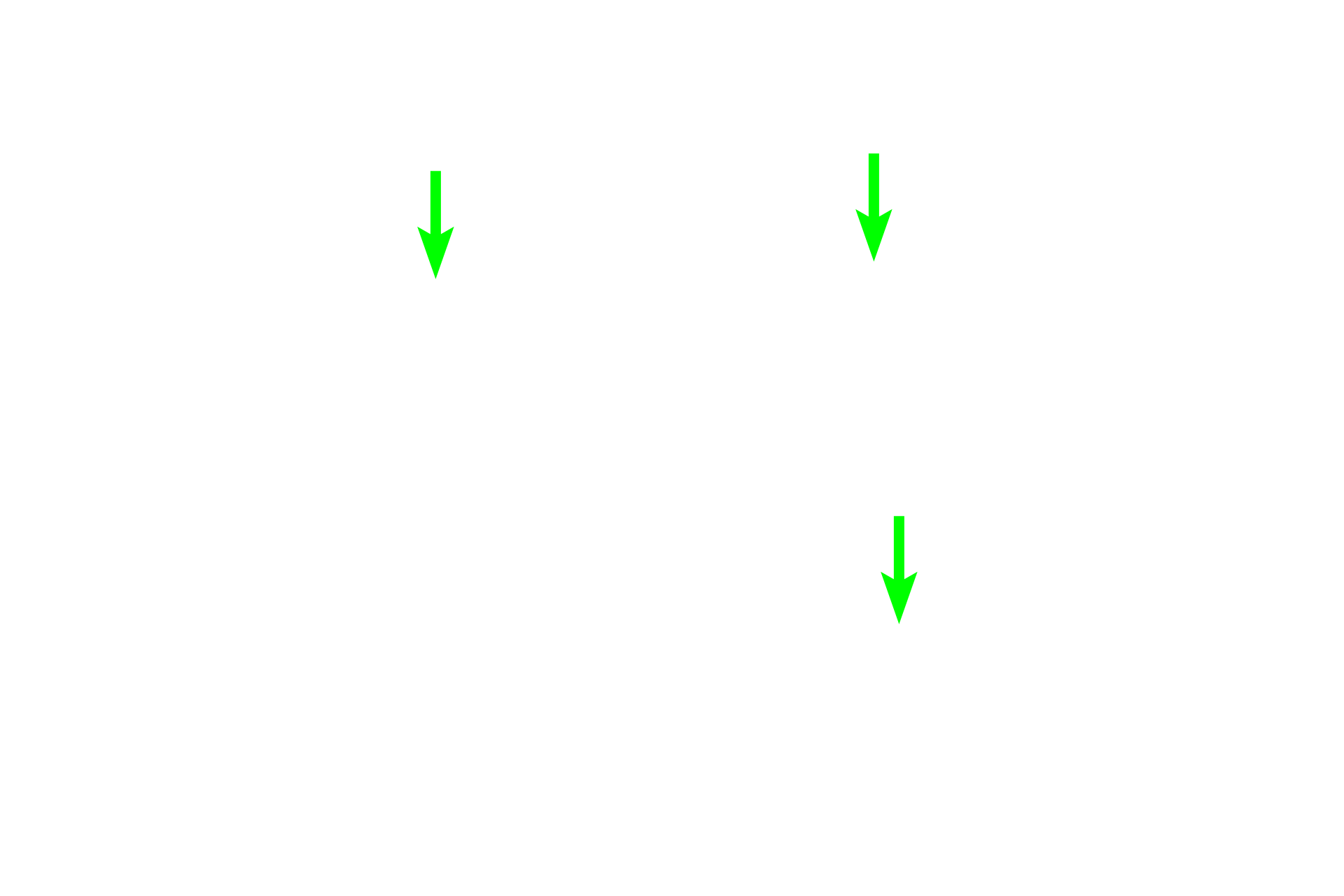 Lamina propria <p>Bronchioles often appear constricted due to postmortem contraction of the prominent smooth muscle layer. Similar to the previous image, this bronchiole is lined by a ciliated, pseudostratified columnar epithelium. Note the absence of both cartilage plates and glands.  200x  </p>
