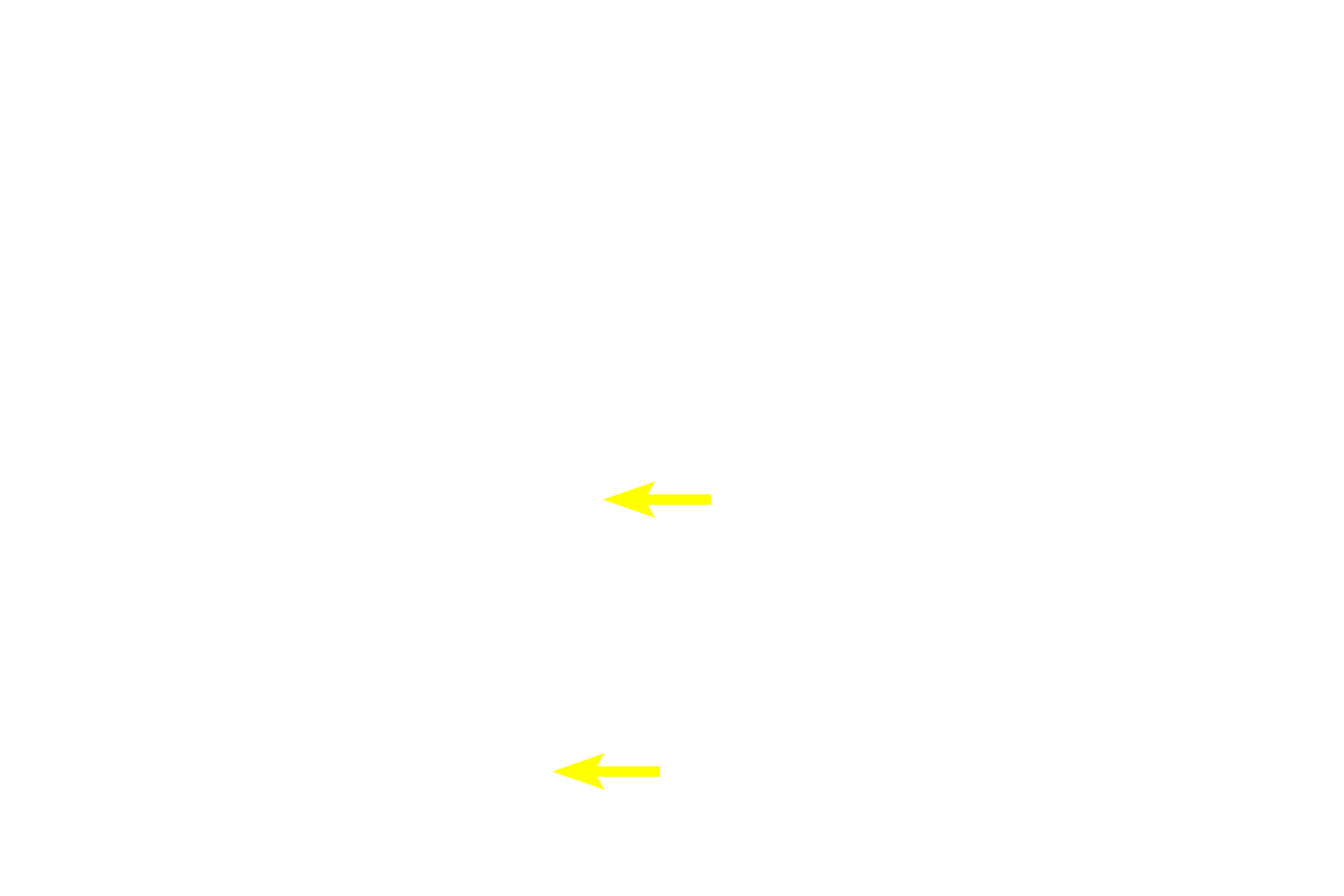 Bronchial vessels >  <p>These capillaries are part of the bronchial blood supply that provides oxygen and nutrients to the wall of respiratory passageways. They are not involved in gas exchange with the air.</p>
