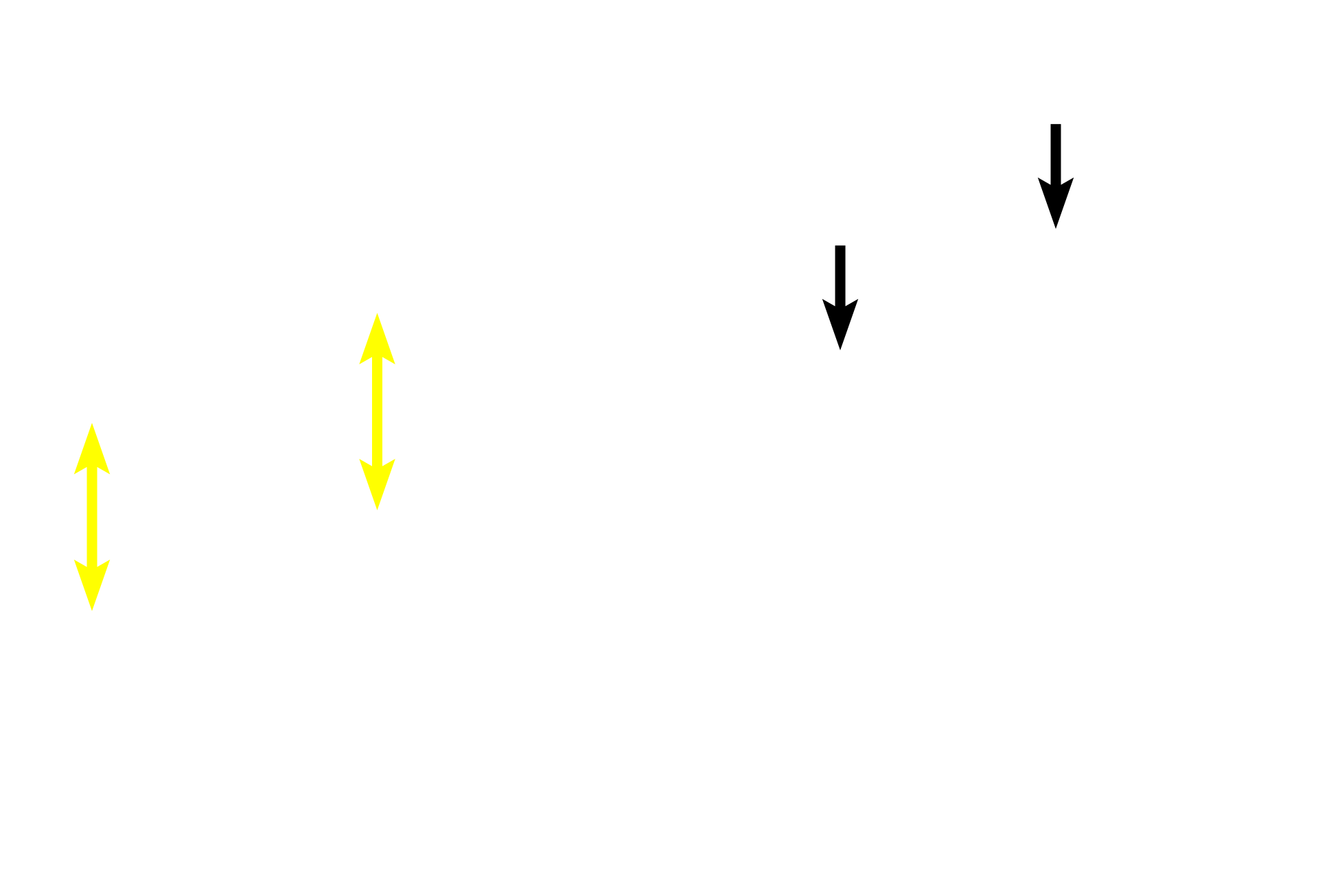 Epithelium <p>As bronchioles decrease in diameter, the height of the epithelium transitions from pseudostratified columnar to simple columnar (left) to simple cuboidal (right). Additionally, goblet cells and cilia become less numerous and the overall thickness of the wall decreases.  600x</p>

