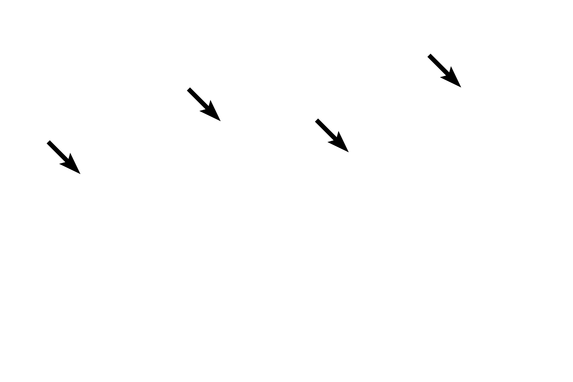  - Cilia <p>As bronchioles decrease in diameter, the height of the epithelium transitions from pseudostratified columnar to simple columnar (left) to simple cuboidal (right). Additionally, goblet cells and cilia become less numerous and the overall thickness of the wall decreases.  600x</p>
