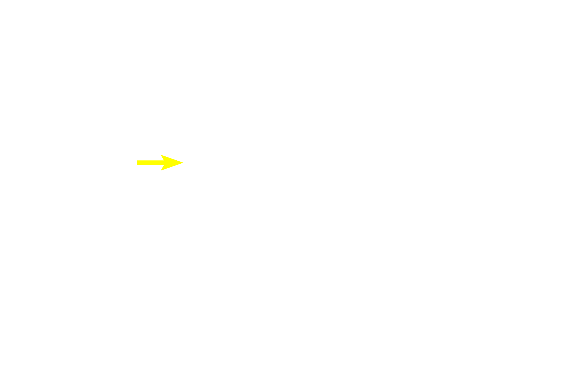  - Goblet cell <p>As bronchioles decrease in diameter, the height of the epithelium transitions from pseudostratified columnar to simple columnar (left) to simple cuboidal (right). Additionally, goblet cells and cilia become less numerous and the overall thickness of the wall decreases.  600x</p>
