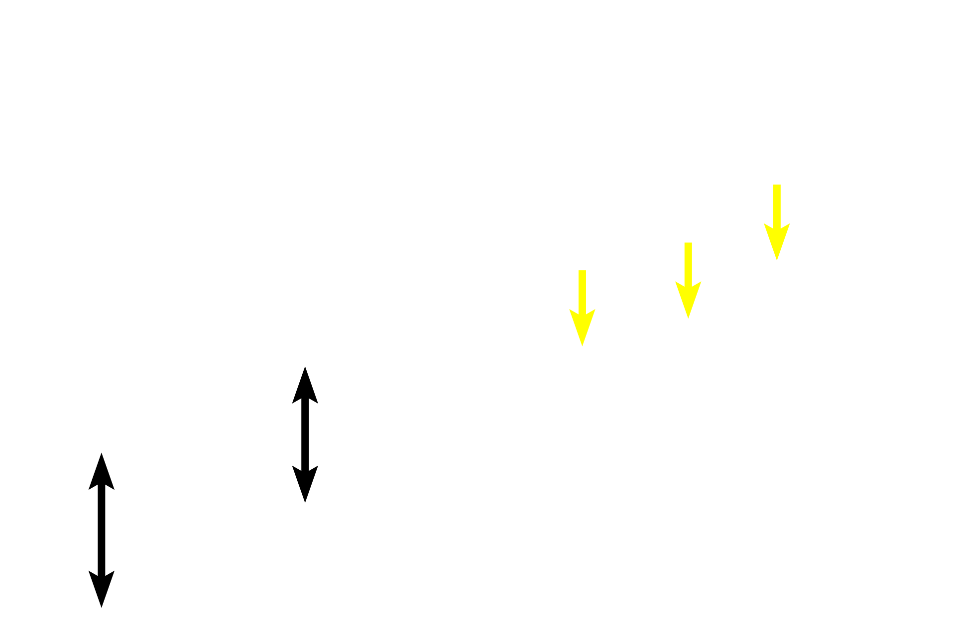 Smooth muscle <p>As bronchioles decrease in diameter, the height of the epithelium transitions from pseudostratified columnar to simple columnar (left) to simple cuboidal (right). Additionally, goblet cells and cilia become less numerous and the overall thickness of the wall decreases.  600x</p>
