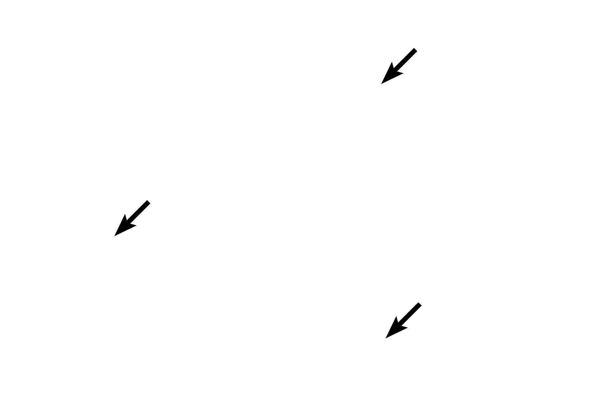Epithelium <p>As bronchioles continue to decrease in diameter they transition to the smallest conducting bronchioles, called terminal bronchioles. Their simple cuboidal epithelium has reduced cilia and lacks goblet cells. Another secretory cell type, club cells, first appears in terminal bronchioles and continue into respiratory bronchioles. Club cells are not visible in this image.  400x</p>
