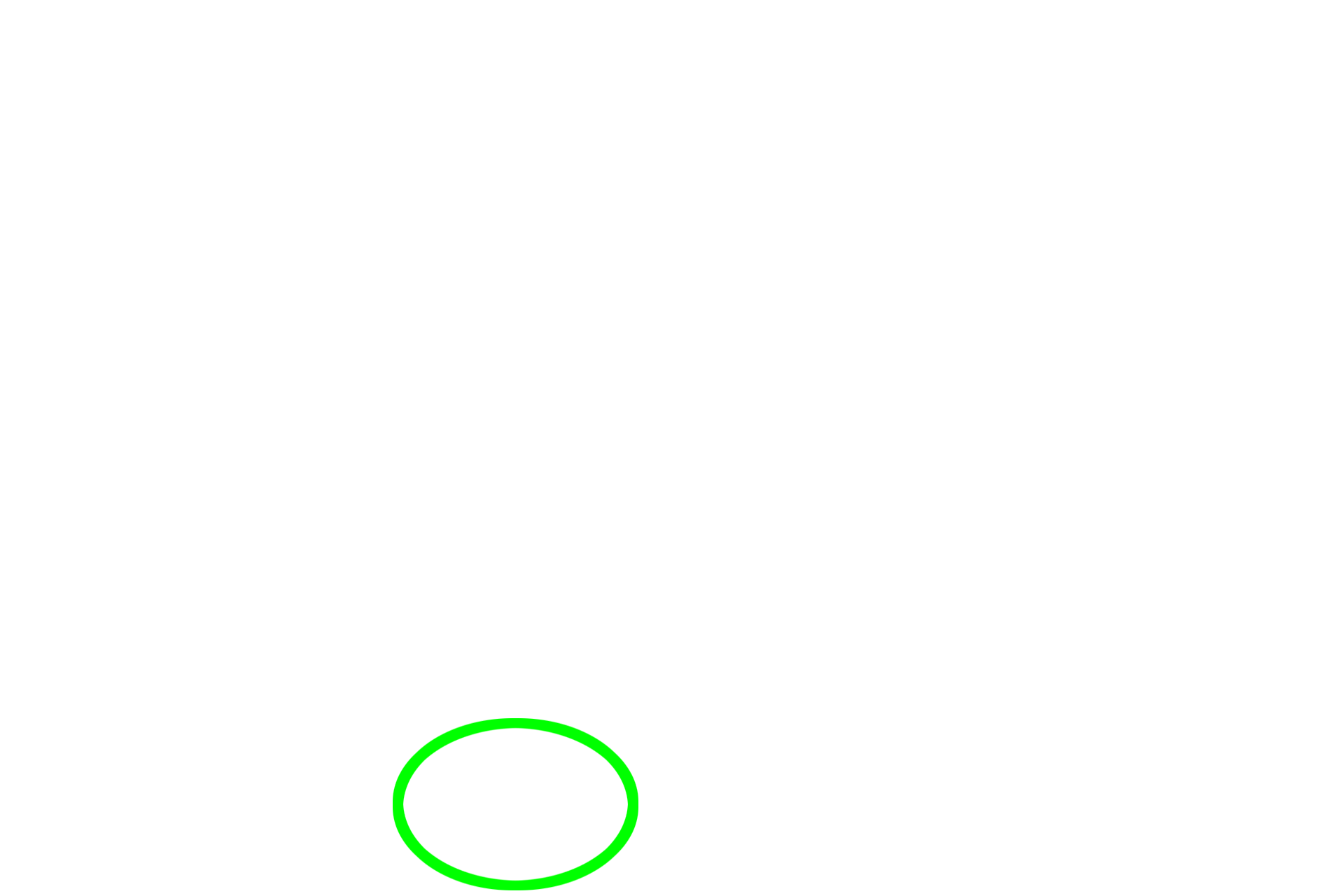 Lymphoid tissue <p>As bronchioles continue to decrease in diameter they transition to the smallest conducting bronchioles, called terminal bronchioles. Their simple cuboidal epithelium has reduced cilia and lacks goblet cells. Another secretory cell type, club cells, first appears in terminal bronchioles and continues into respiratory bronchioles. Club cells often bulge into the lumen. The terminal bronchiole is surrounded by alveoli and lies adjacent to a pulmonary artery.  400x</p>

