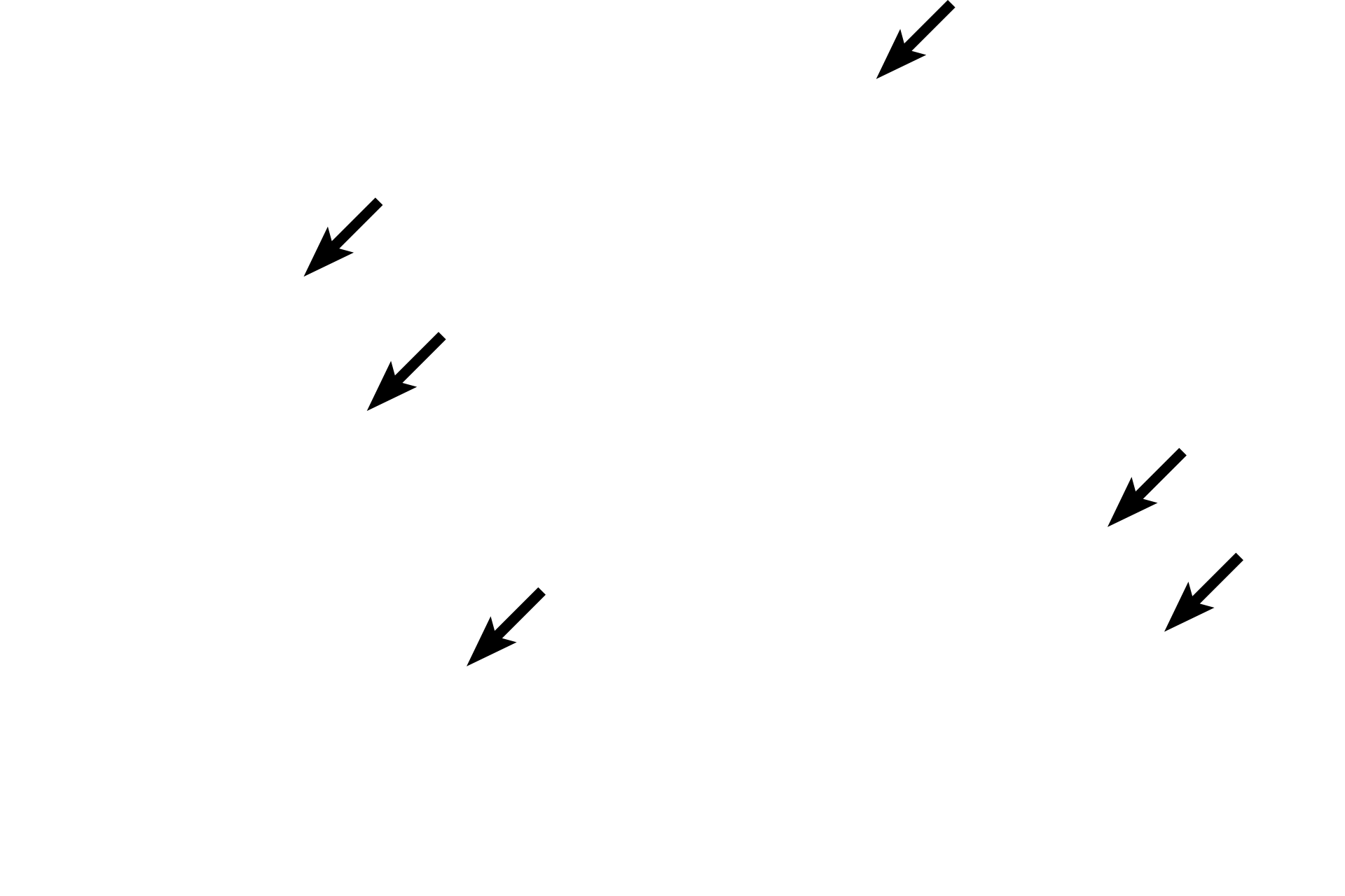  - Secretory granules <p>Club cells first appear in the terminal bronchiole and continue in respiratory bronchioles. They are not ciliated and their apical ends bulge into the lumen of the airway. They protect the epithelium by degrading inhaled toxins and secreting a lipoprotein that prevents luminal adhesion. Club cells also serve as progenitors for themselves and ciliated cells.  600x</p>
