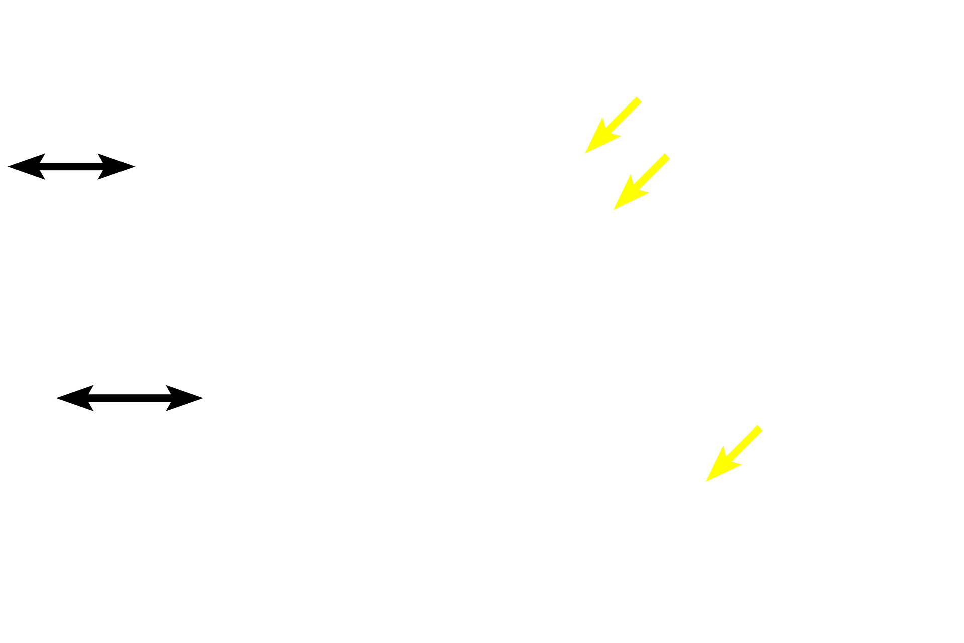 Smooth muscle <p>Club cells first appear in the terminal bronchiole and continue in respiratory bronchioles. They are not ciliated and their apical ends bulge into the lumen of the airway. They protect the epithelium by degrading inhaled toxins and secreting a lipoprotein that prevents luminal adhesion. Club cells also serve as progenitors for themselves and ciliated cells.  600x</p>
