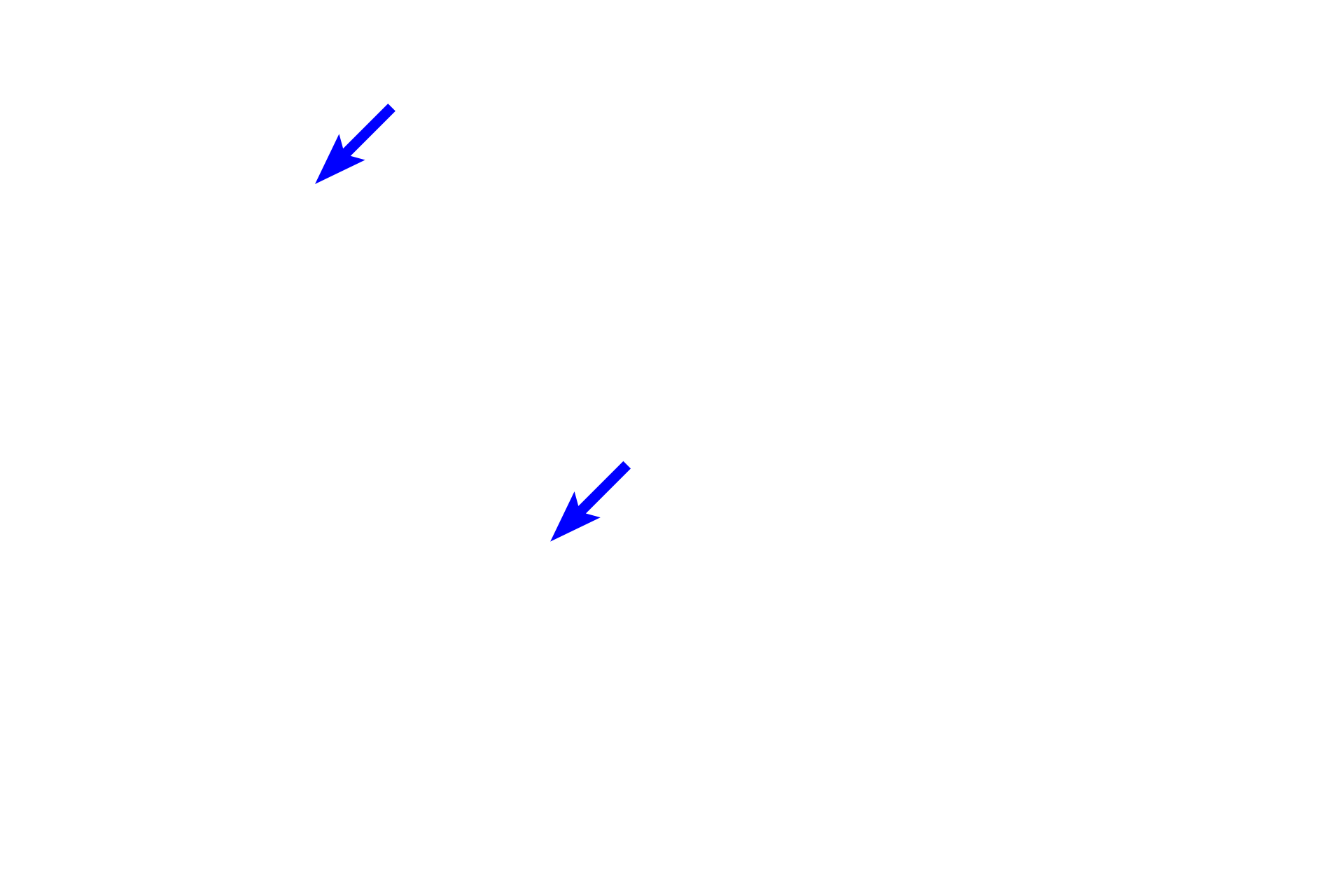 Cartilage plates <p>This longitudinal section shows a respiratory passageway transitioning from a bronchus (left of the line) to a bronchiole (right of the line). Both are lined by a pseudostratified columnar epithelium with cilia and goblet cells, and their mucosae contain smooth muscle. Cartilage and glands are not present in the bronchiole, a features that serve to readily distinguish these passageways. 100x</p>
