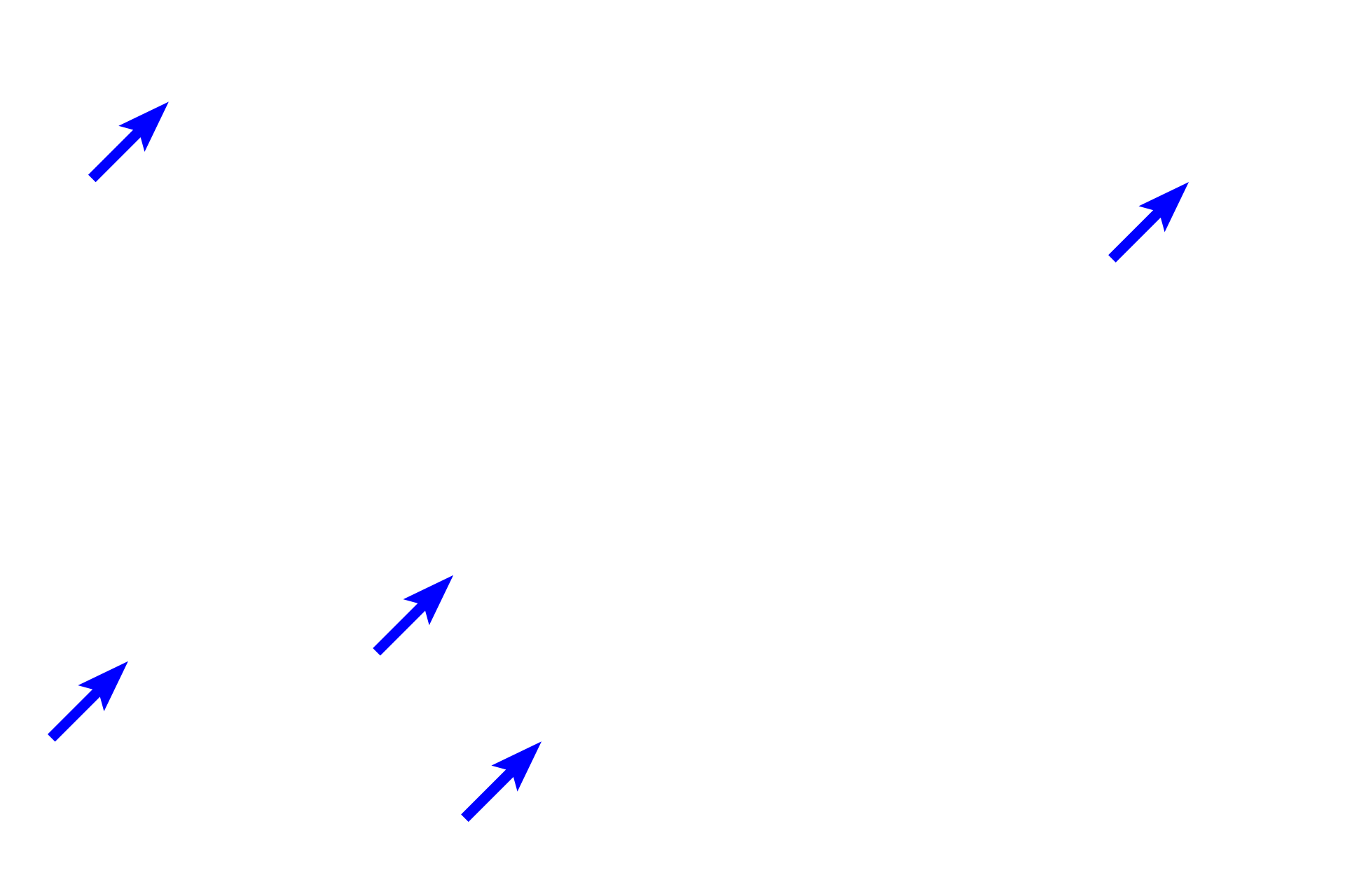 Alveoli <p>This longitudinal section shows a respiratory passageway transitioning from a bronchus (left of the line) to a bronchiole (right of the line). Both are lined by a pseudostratified columnar epithelium with cilia and goblet cells, and their mucosae contain smooth muscle. Cartilage and glands are not present in the bronchiole, a features that serve to readily distinguish these passageways. 100x</p>

