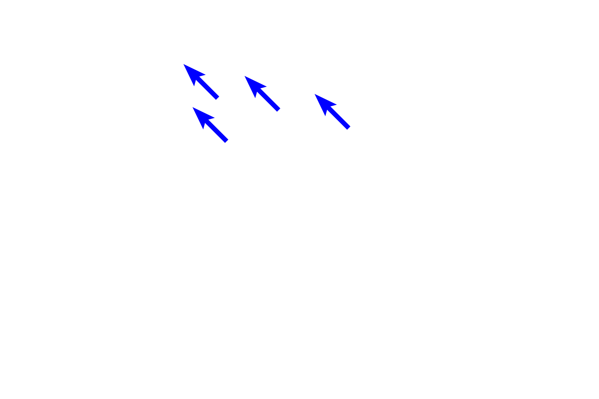 Macrophages > <p>The black carbon particles are located in macrophages that have phagocytosed inhaled particulate matter. These cells, often referred to as dust cells, migrate into alveolar spaces where they remove debris and then accumulate in the surrounding connective tissue.</p>
