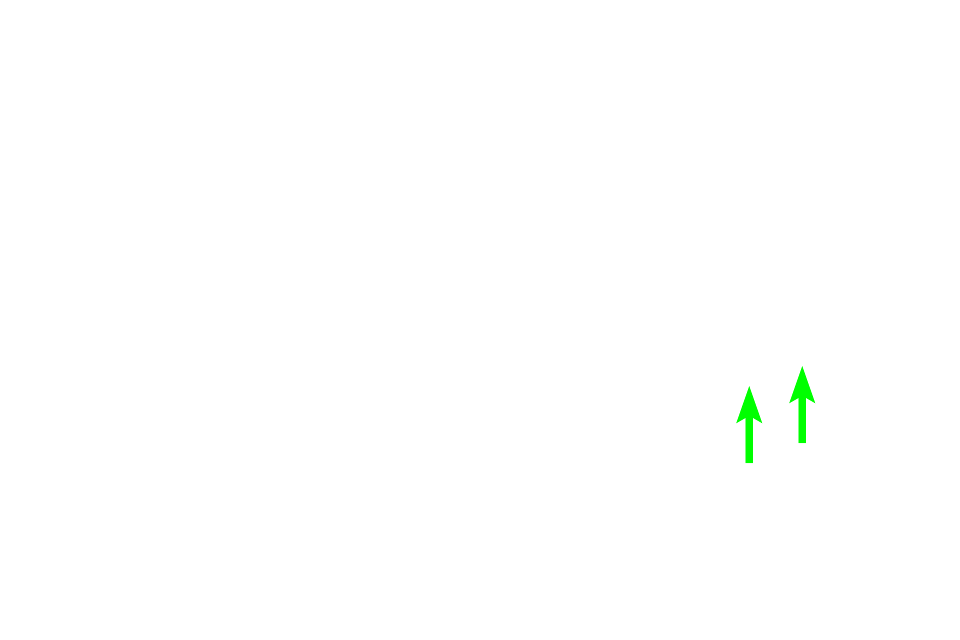  - Fibroblast <p>The interalveolar septum is the wall between adjacent alveoli. It is lined by a simple squamous epithelium of Type I cells and cuboidal Type II cells (septal cells). The connective tissue core of the septum possesses connective tissue cells and reticular and elastic fibers. Numerous capillaries protrude from the septa into alveolar spaces to facilitate gas exchange. The alveolus is coated by a thin film of surfactant that prevents the alveolus from collapsing.</p>
