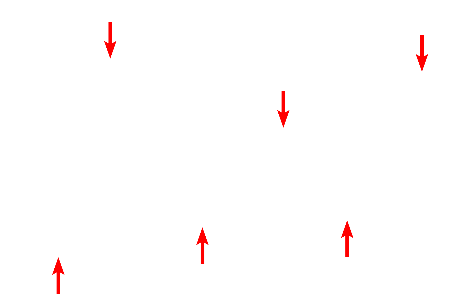 Surfactant layer <p>Type II cells (septal cells or Type II pneumocytes) also line the alveolar space although they cover far less surface area than do the Type I cells. These cuboidal cells can be identified by their frothy cytoplasm, indicative of the phospholipid surfactant they secrete. The thin surfactant layer reduces surface tension, thus aiding inflation of the alveoli during inspiration and preventing collapse.</p>
