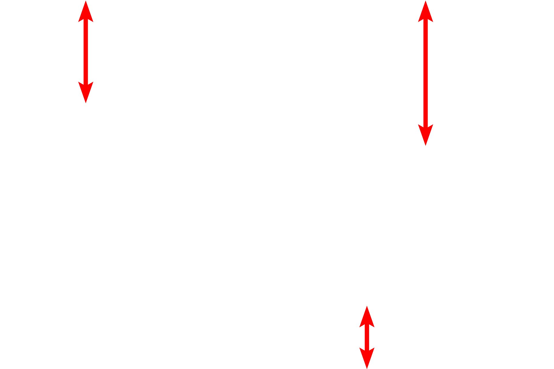 Alveolar lumens <p>This electron micrograph shows many of the components of the interalveolar septum illustrated in the previous illustration. Particularly thin type I cells line the entire alveolus and the bulging of capillaries into the air space is prominent. Surfactant is not preserved during fixation of lung tissue, and no septal cells nor macrophages are present in this image. 4000x</p>
