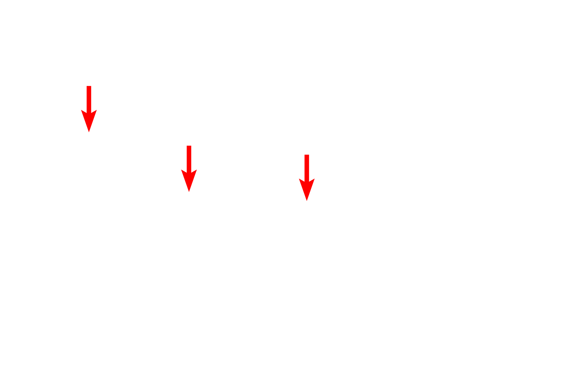 - Connective tissue core <p>This electron micrograph shows many of the components of the interalveolar septum illustrated in the previous illustration. Particularly thin type I cells line the entire alveolus and the bulging of capillaries into the air space is prominent. Surfactant is not preserved during fixation of lung tissue, and no septal cells nor macrophages are present in this image. 4000x</p>
