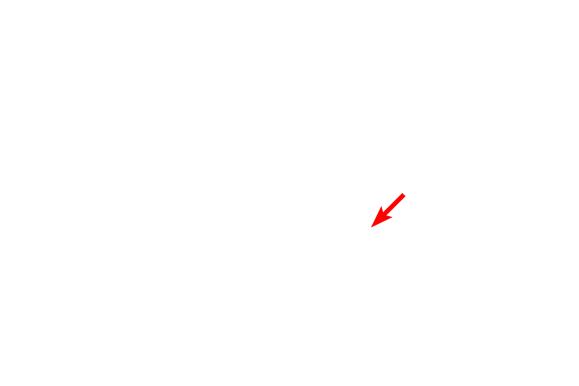  - Fibroblast <p>This electron micrograph shows many of the components of the interalveolar septum illustrated in the previous illustration. Particularly thin type I cells line the entire alveolus and the bulging of capillaries into the air space is prominent. Surfactant is not preserved during fixation of lung tissue, and no septal cells nor macrophages are present in this image. 4000x</p>
