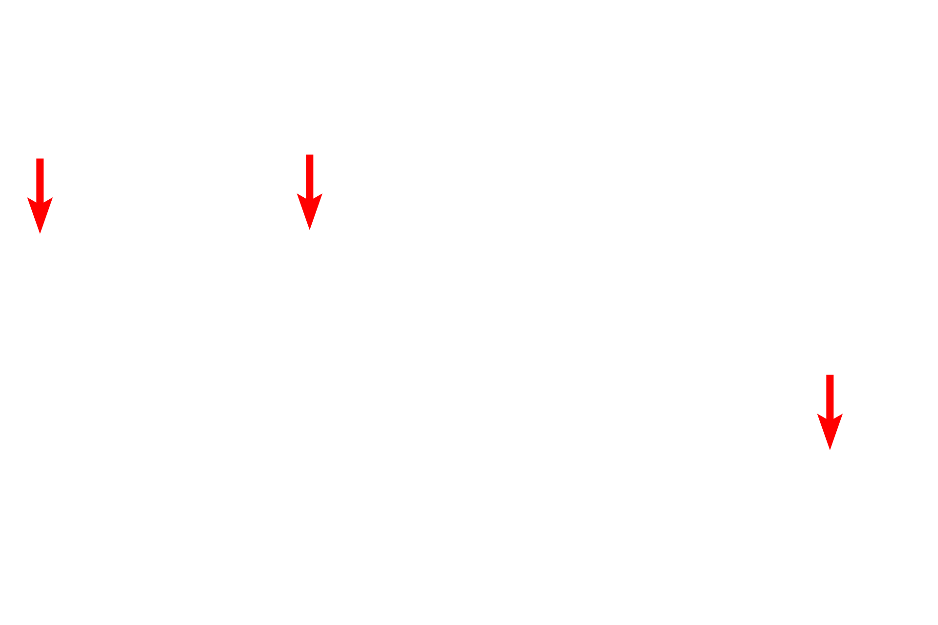 - Endothelial cell nuclei <p>This electron micrograph shows many of the components of the interalveolar septum illustrated in the previous illustration. Particularly thin type I cells line the entire alveolus and the bulging of capillaries into the air space is prominent. Surfactant is not preserved during fixation of lung tissue, and no septal cells nor macrophages are present in this image. 4000x</p>
