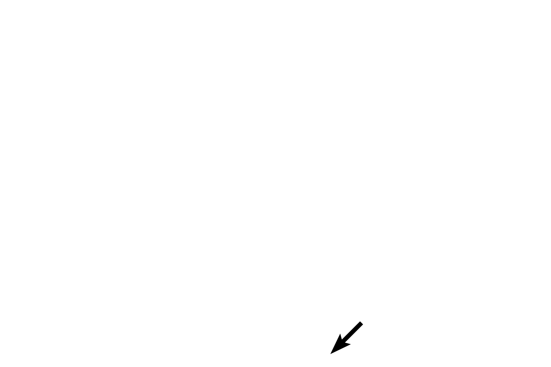  - Type I cell <p>The interalveolar septum is lined by a simple squamous epithelium of Type I cells and cuboidal Type II septal cells. Septal cells produce secretory granules containing surfactant, a mixture of phospholipids and proteins. Their frothy appearance results from extraction of these components during tissue processing. Septal cells are more numerous than type I cells, but only cover 5% to 7% of the surface. Septal cells divide to replenish both their own cell line and type I cells. 1000x </p>
