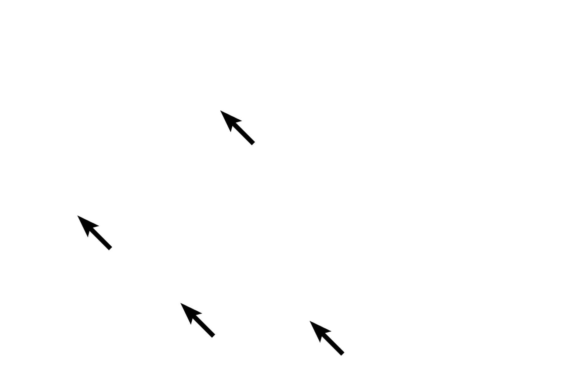  - Type II cells <p>The interalveolar septum is lined by a simple squamous epithelium of Type I cells and cuboidal Type II septal cells. Septal cells produce secretory granules containing surfactant, a mixture of phospholipids and proteins. Their frothy appearance results from extraction of these components during tissue processing. Septal cells are more numerous than type I cells, but only cover 5% to 7% of the surface. Septal cells divide to replenish both their own cell line and type I cells. 1000x </p>
