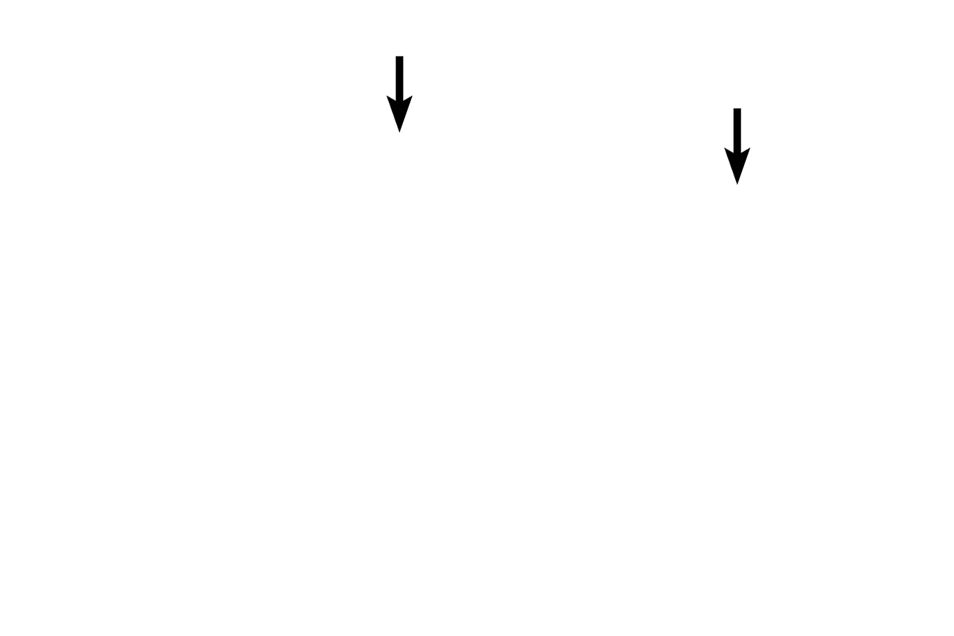 Smooth muscle knobs <p>This alveolus is associated with an alveolar duct and thus the tips of the interalveolar septa possess smooth muscle knobs</p>
