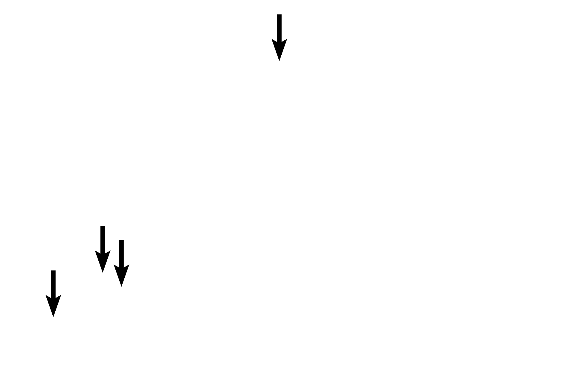  -- Secretory granules <p>Septal cells (type II alveolar cells) form the remainder of the alveolar lining. These spherical cells bulge into the alveolar space and are the source of surfactant. Their secretory granules, also called lamellar bodies, contain phospholipids which are extracted during routine tissue processing, resulting in their frothy appearance. The surfactant layer reduces surface tension, thus aiding inflation of the alveoli during inspiration and preventing collapse.</p>
