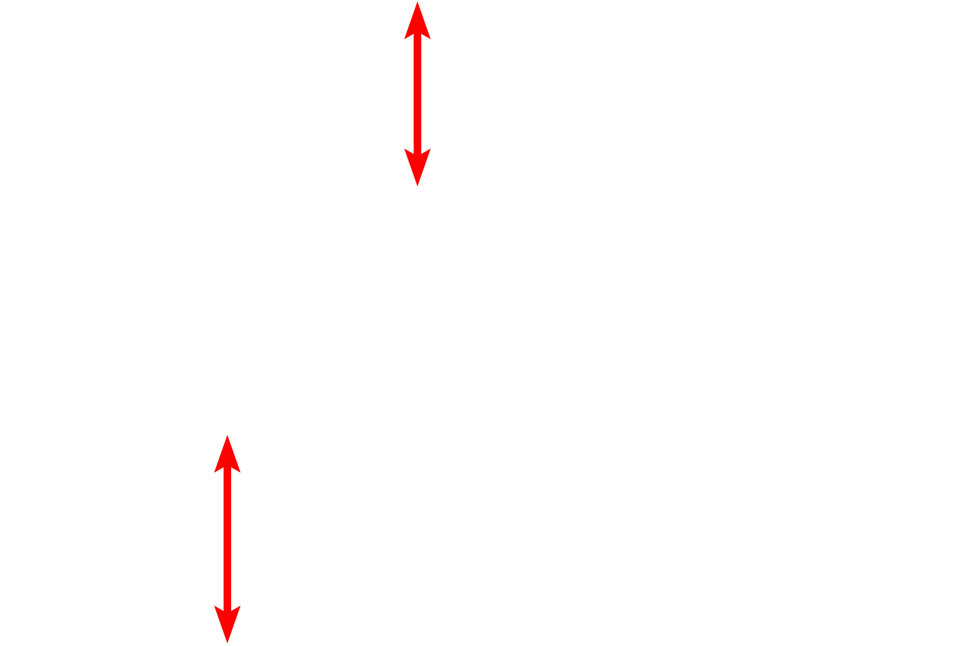 Alveolar lumens <p>By electron microscopy, the details of the interalveolar septum are more evident, particularly the cytology of a type II (septal) cell. Septal cells secrete surfactant, a mixture of phospholipids and protein. The secretory granules (vesicles) are often referred to as lamellar bodies, due to their lipid content. One granule in the process of exocytosis is visible. 4000x</p>
