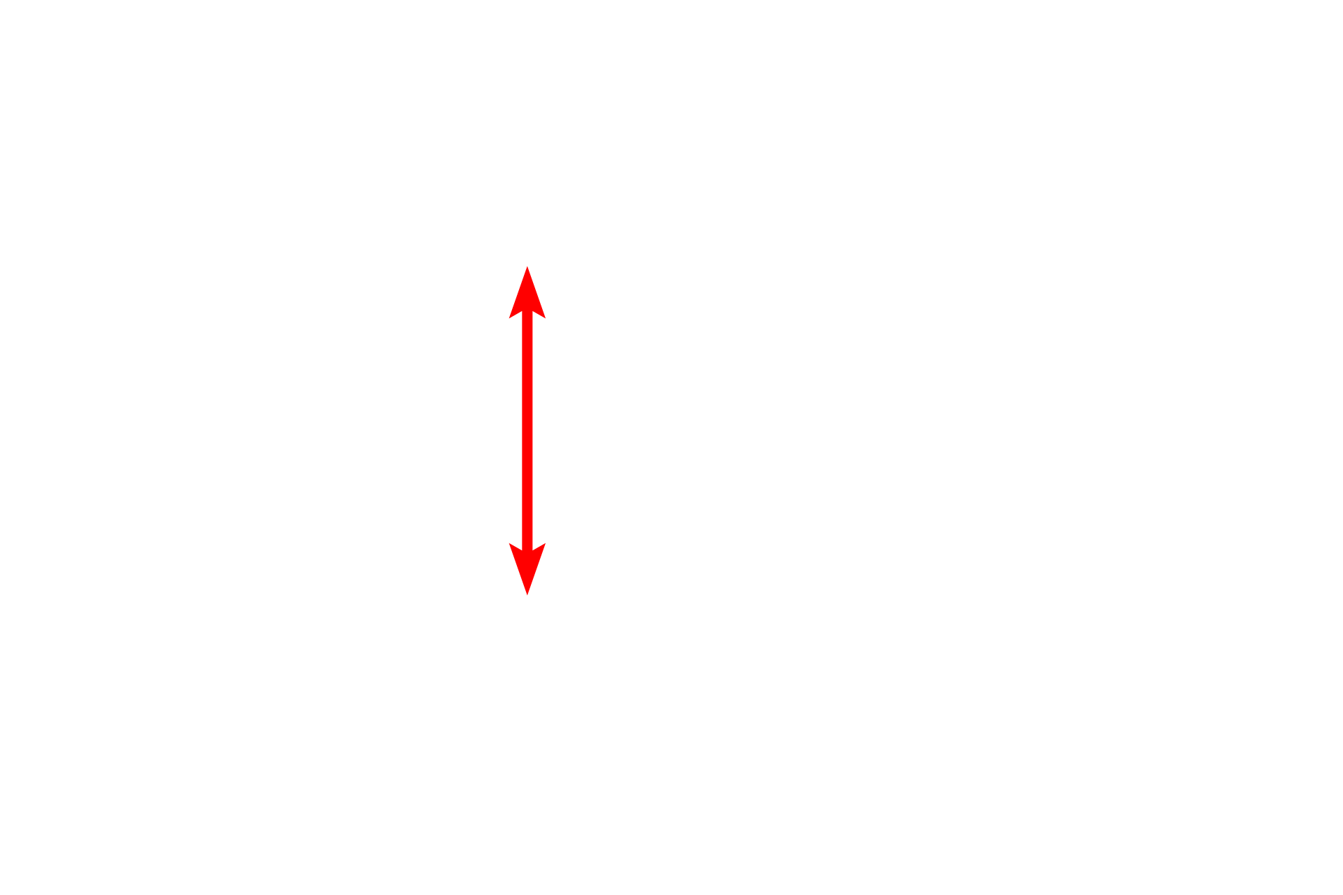 Interalveolar septum <p>By electron microscopy, the details of the interalveolar septum are more evident, particularly the cytology of a type II (septal) cell. Septal cells secrete surfactant, a mixture of phospholipids and protein. The secretory granules (vesicles) are often referred to as lamellar bodies, due to their lipid content. One granule in the process of exocytosis is visible. 4000x</p>
