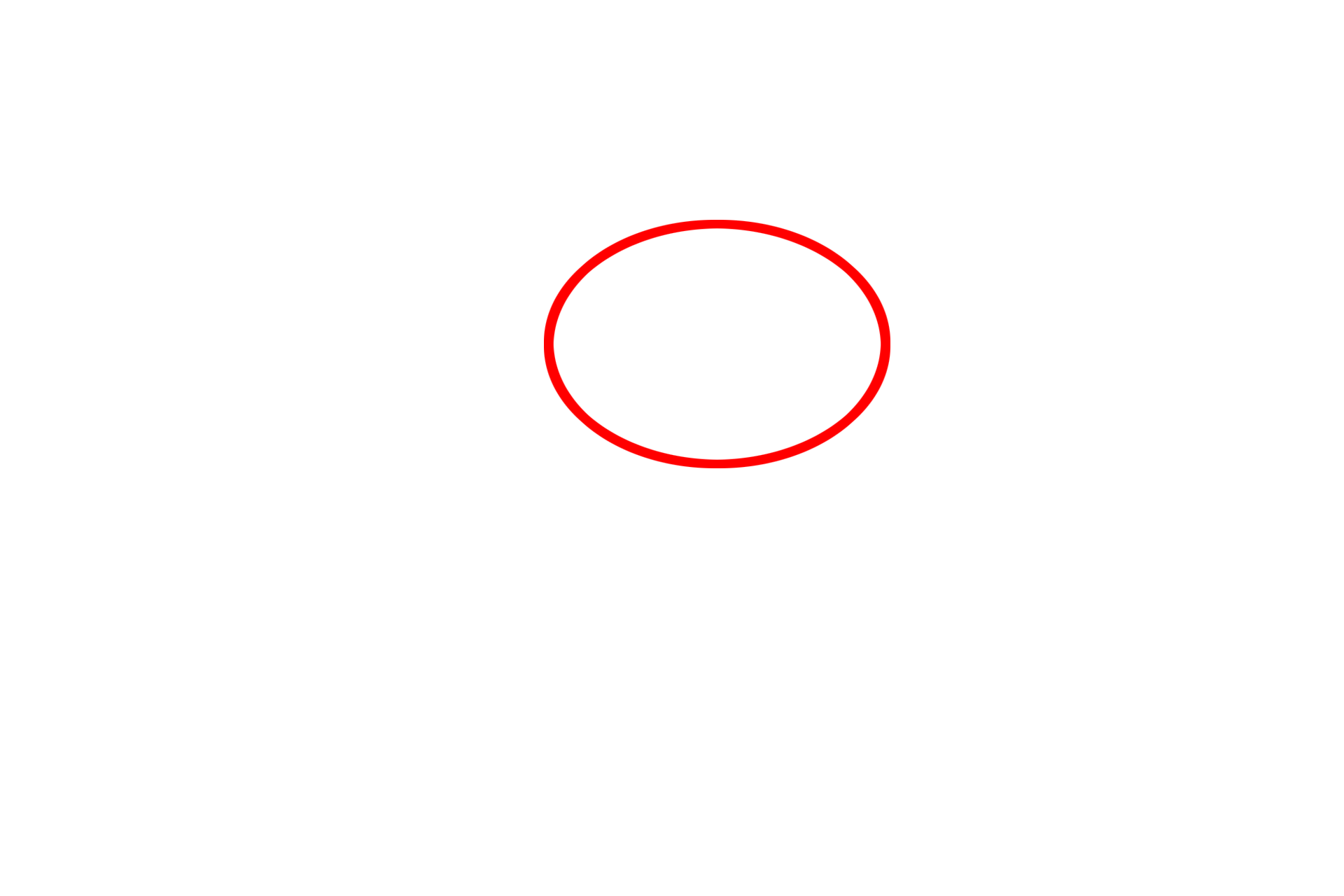  - Type II cell <p>By electron microscopy, the details of the interalveolar septum are more evident, particularly the cytology of a type II (septal) cell. Septal cells secrete surfactant, a mixture of phospholipids and protein. The secretory granules (vesicles) are often referred to as lamellar bodies, due to their lipid content. One granule in the process of exocytosis is visible. 4000x</p>
