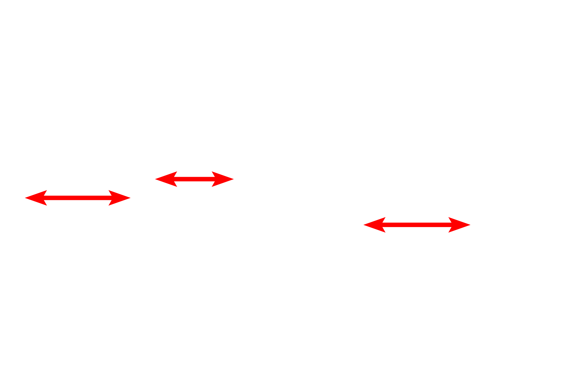  - Capillaries <p>By electron microscopy, the details of the interalveolar septum are more evident, particularly the cytology of a type II (septal) cell. Septal cells secrete surfactant, a mixture of phospholipids and protein. The secretory granules (vesicles) are often referred to as lamellar bodies, due to their lipid content. One granule in the process of exocytosis is visible. 4000x</p>
