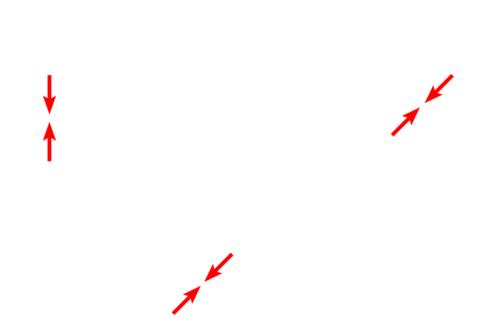 Air-blood barrier <p>By electron microscopy, the details of the interalveolar septum are more evident, particularly the cytology of a type II (septal) cell. Septal cells secrete surfactant, a mixture of phospholipids and protein. The secretory granules (vesicles) are often referred to as lamellar bodies, due to their lipid content. One granule in the process of exocytosis is visible. 4000x</p>
