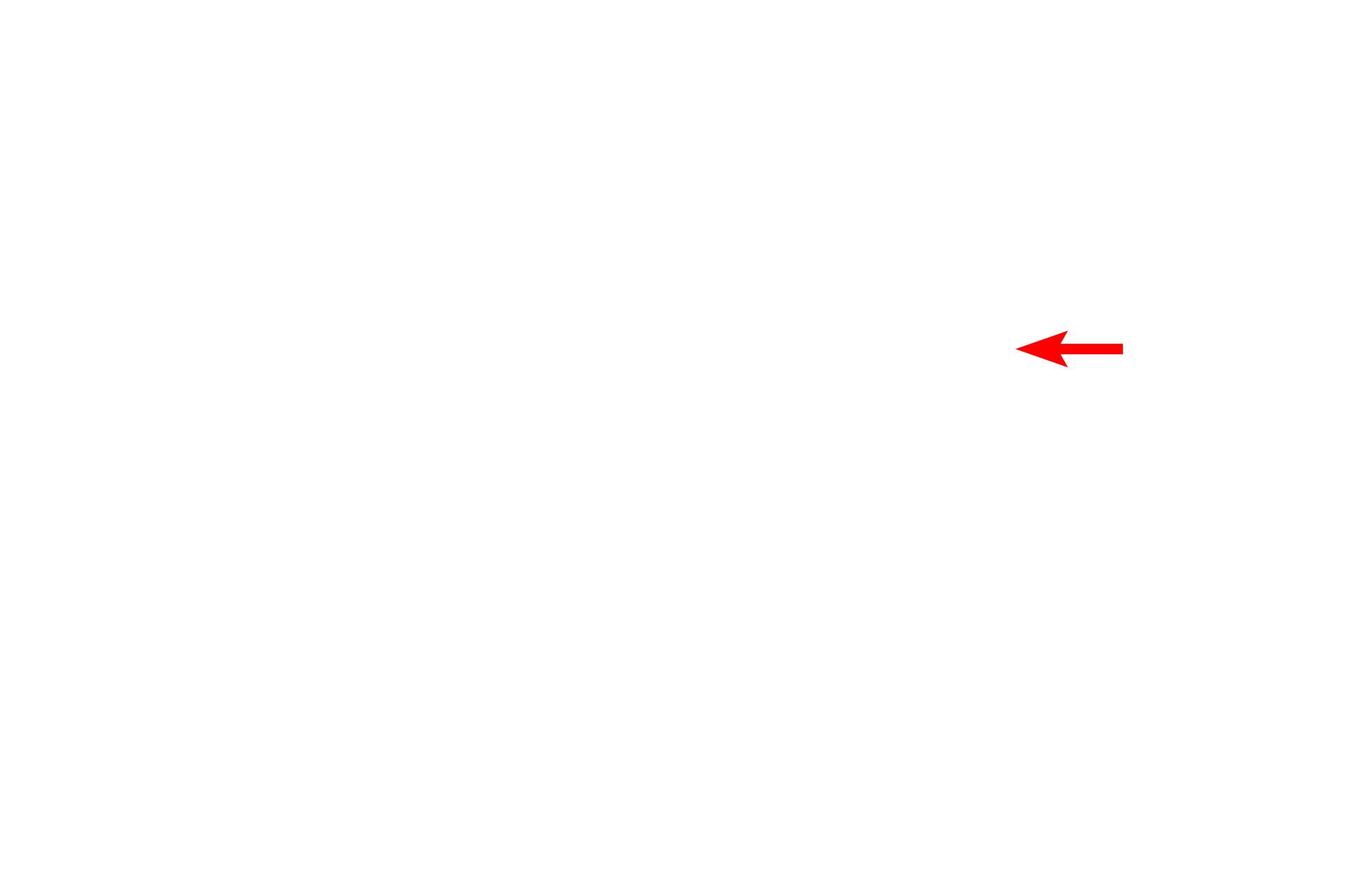  - Type I cell > <p>Type I cells (pulmonary epithelial cells) line the alveolus; their nuclei protrude into the alveolar space. Endothelial cell nuclei face the capillary lumen and are frequently curved to assume the shape of that lumen. Septal cells (type II alveolar cells) are large, vacuolated cells that bulge into the alveolus.</p>
