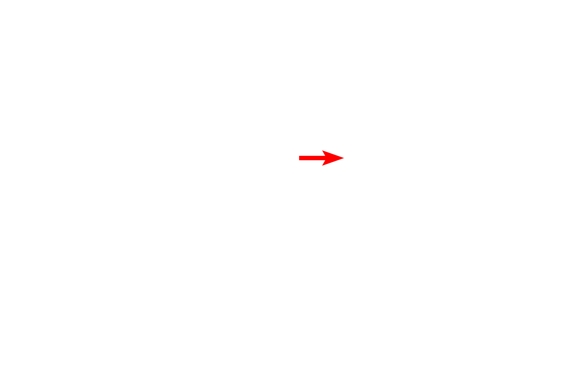  - Type II cell <p>Type I cells (pulmonary epithelial cells) line the alveolus; their nuclei protrude into the alveolar space. Endothelial cell nuclei face the capillary lumen and are frequently curved to assume the shape of that lumen. Septal cells (type II alveolar cells) are large, vacuolated cells that bulge into the alveolus.</p>
