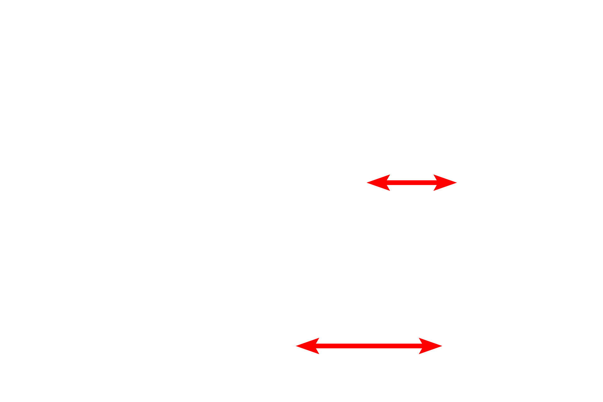 Interalveolar septum <p>The third cell type present in the alveolus is the alveolar macrophage, which can be can also be found in the interalveolar septum. Because the surface of the alveolus is continuous with the exterior, these cells actually function outside the body.  1000x</p>
