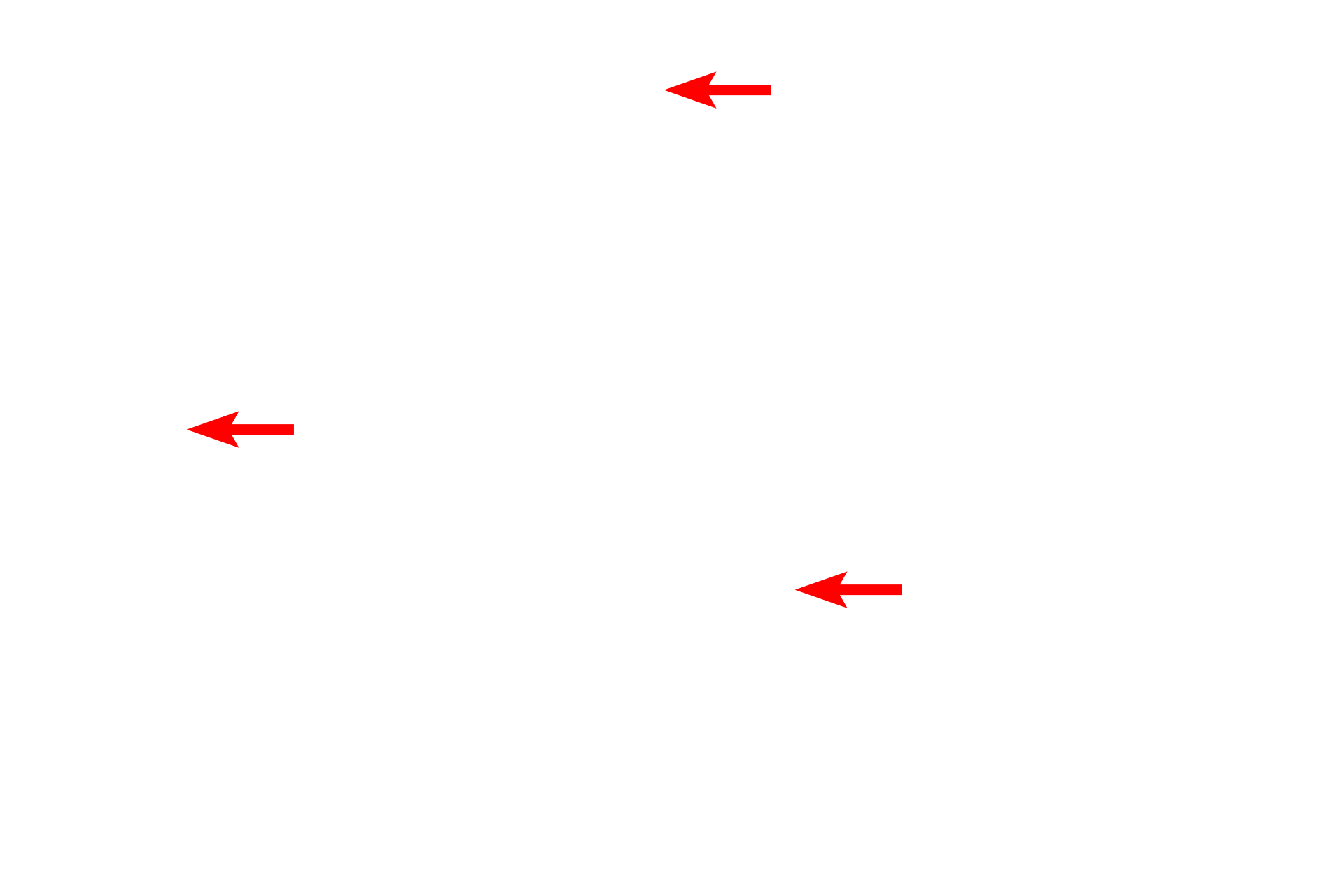  - Endothelial cell nuclei <p>Capillaries form 80% of the wall of the alveolus and are supplied with deoxygenated blood by branches of pulmonary arteries. After oxygenation, blood is returned by the pulmonary venous system. The air-blood barrier consists of a simple squamous epithelium (type I) lining the alveolus and a simple squamous epithelium (endothelium) lining the capillary, along with their fused basal laminae.</p>
