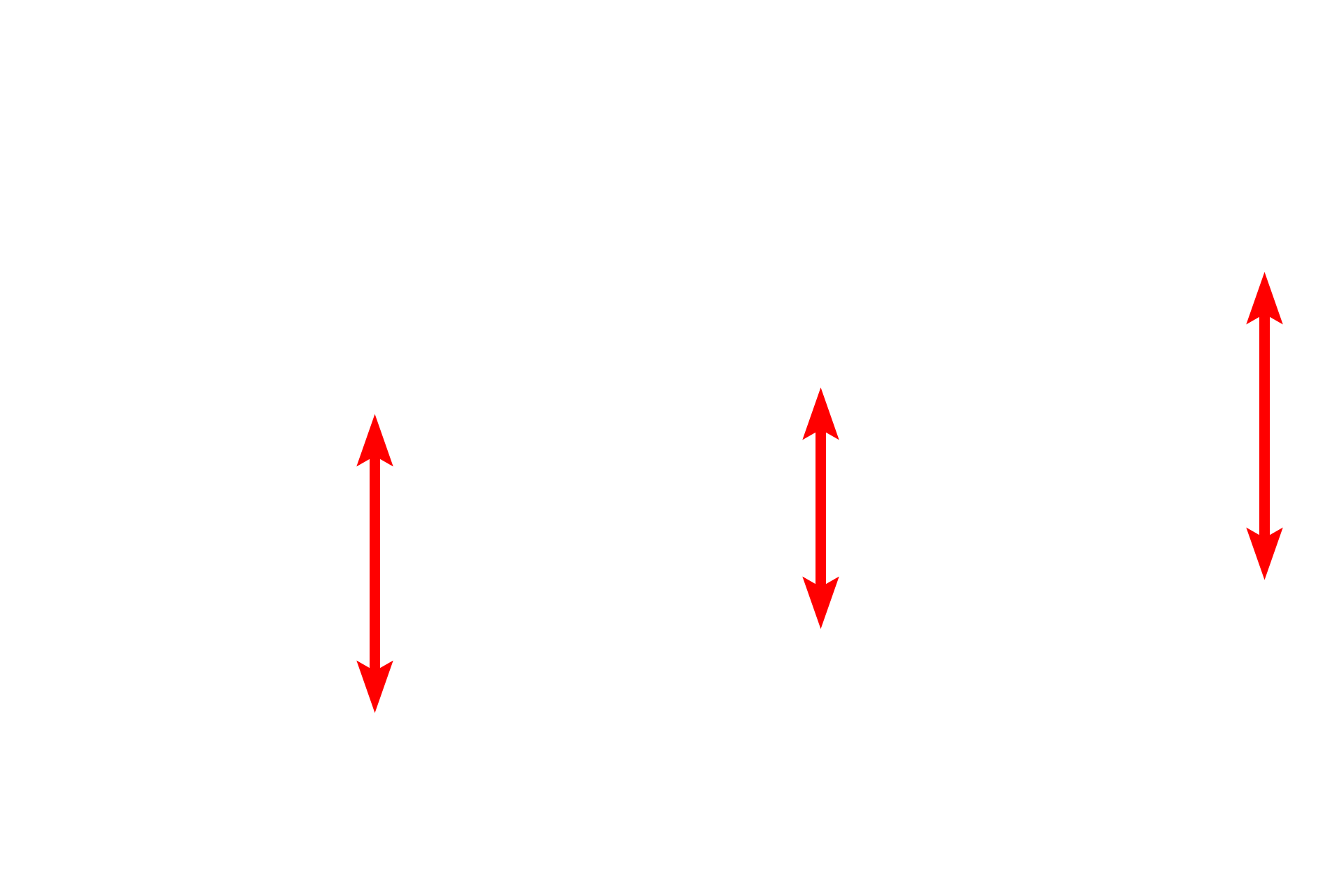  - Capillaries <p>An alveolar macrophage is seen lying in the lumen of an alveolus, adjacent to the interalveolar septum. Abundant phagocytosed material is visible in its cytoplasm. The attenuated cytoplasm of the type I cells lines the interalveolar septum with its numerous capillaries. Septal cells can be identified by the vacuolated secretory granules in their cytoplasm. These granules contain lipoprotein that serves as a surfactant.  5000x</p>
