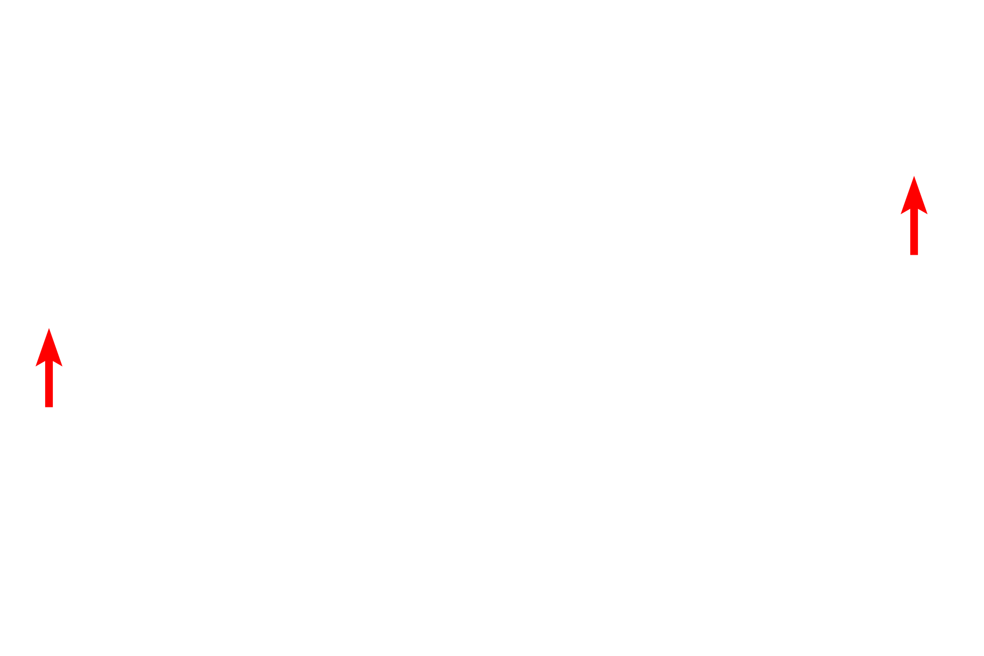 Pulmonary vessels <p>This image shows another example of a respiratory bronchiole branching to forming multiple alveolar ducts. Alveolar ducts consist almost entirely of alveoli, the wall being reduced to knob-like interalveolar septa. Alveolar ducts end as alveolar sacs with alveoli clustered around a central space.  40x</p>
