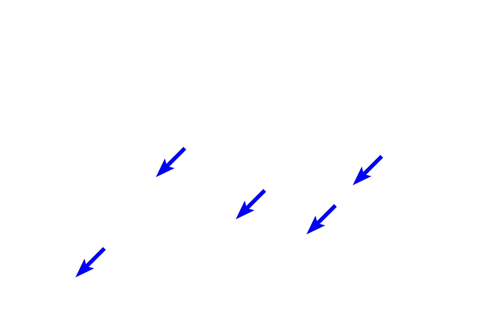 Capillaries <p>The wall of an alveolar duct, seen here at higher magnification, consist entirely of alveoli separated by thin interalveolar septa, capped by knobs with smooth muscle cells. The alveolar wall contains numerous capillaries for gas exchange with inspired air.  500x</p>
